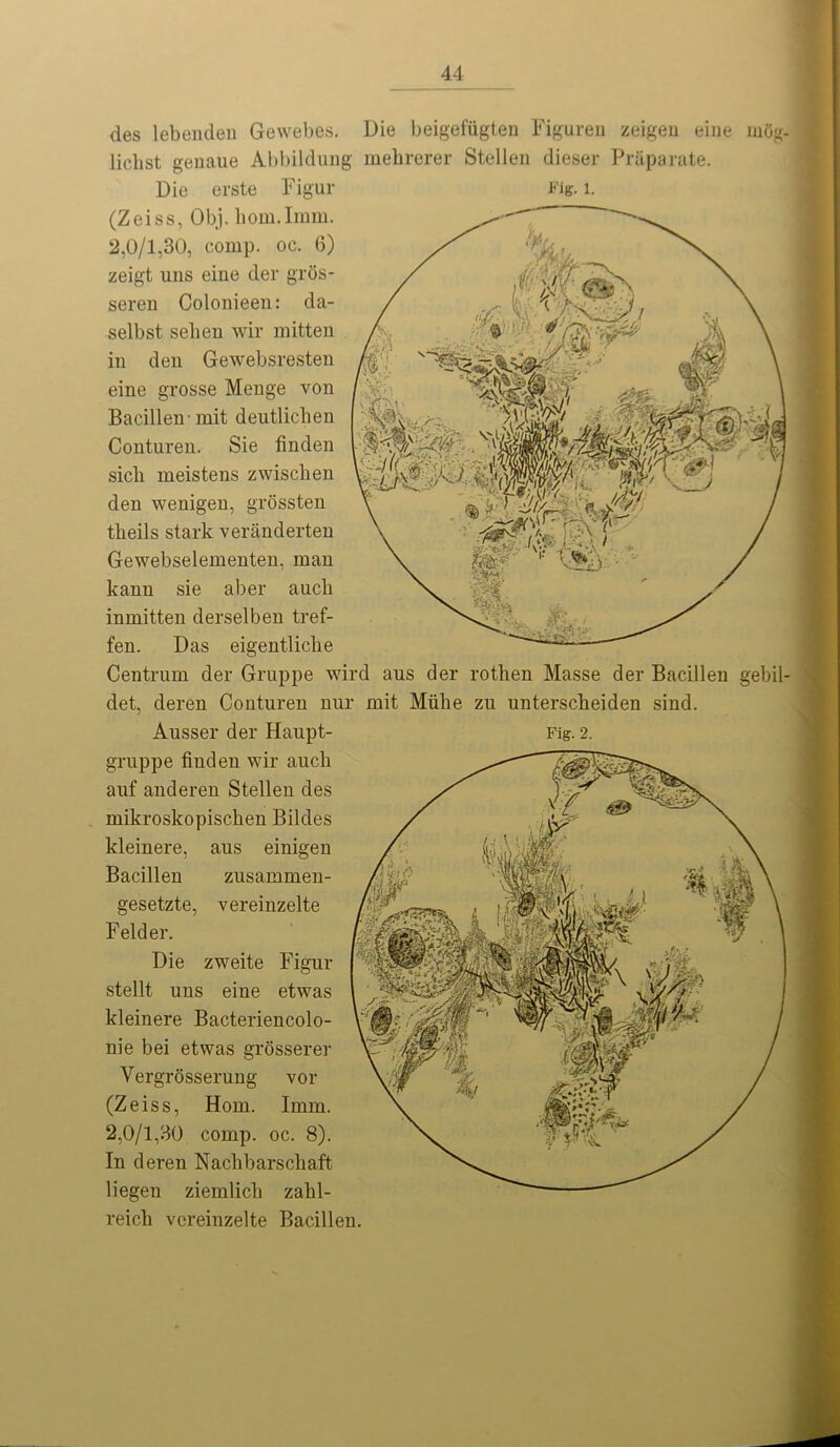 des lebenden Gewebes. Die beigefiigten Figureu zeigeu eine wdg- lichst genaue Abbildung mehrerer Stellen dieser Praparate. Die erste Figur Fig. 1. (Zeiss, Obj. bom.Imm. 2,0/1,30, comp. oc. 6) zeigt uns eine der gros- seren Colonieen: da- selbst seben wir mitten in den Gewebsresten eine grosse Menge von Bacillen'mit deutliclien Conturen. Sie finden sicb meistens zwischen den wenigen, grossten theils stark veranderten Gewebselementen, man kann sie aber aucb inmitten derselben tref- fen. Das eigentlicbe Centrum der Gruppe wird aus der rothen Masse der Bacillen gebil- det, deren Conturen nur mit Miilie zn unterscbeiden sind. Ausser der Haupt- Fig. 2. gruppe finden wir aucli auf anderen Stellen des mikroskopischen Bildes kleinere, aus einigen Bacillen zusammen- gesetzte, vereinzelte Felder. Die zweite Figur stellt uns eine etwas kleinere Bacteriencolo- nie bei etwas grosserer Vergrosserung vor (Zeiss, Horn. Imm. 2,0/1,30 comp. oc. 8). In deren Nacbbarscliaft liegen ziemlicb zabl- reicb vereinzelte Bacillen.