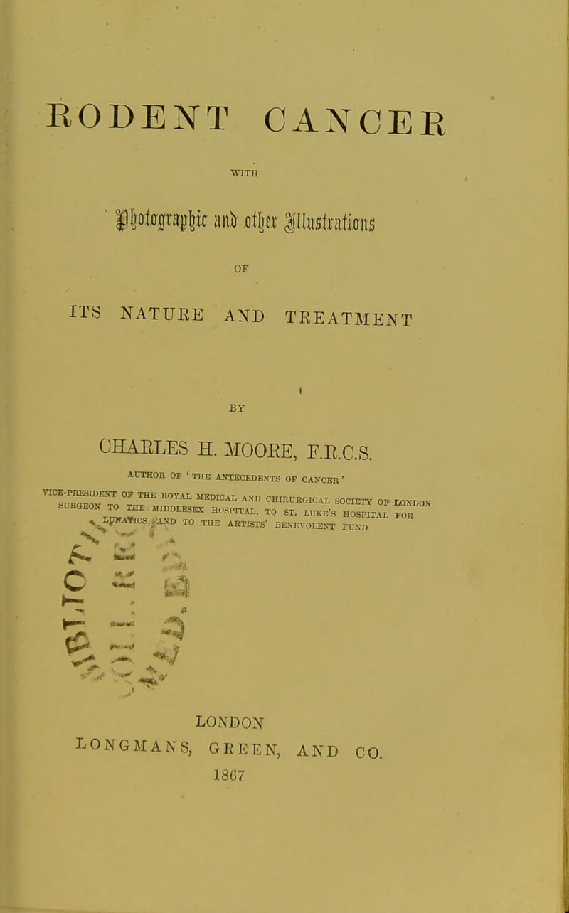 CANCER RODENT WITH Jttotograjjjic mi utter Illustrations OP ITS NATURE AND TREATMENT BY CHARLES H. MOORE, E.R.C.S. AUTHOR OF ‘ THE ANTECEDENTS OF CANCER ’ VICsrn^REXT °F ™E R°YAL MEDICAL CHIRDRGIOAL SOCIETY OF LONDON SURGEON TO THE MIDDLESEX HOSPn'AL, TO ST. LUKE’S HOSPITAL FOR ^ LUNATICS,jfAND TO THE ARTISTS’ BENEVOLENT FUND A- c i* r*> **< .^r . ^ v. ..r __ r LONDON LONGMANS, GREEN, AND CO. 1807