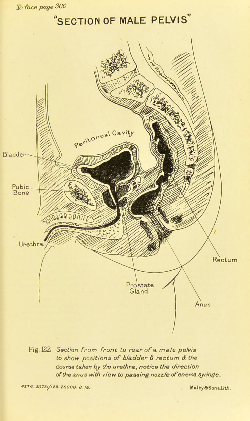 3o face page 300 section of wiale pelvis Fig. 122 Section from front to rear of a. male pelvis to show positions of bladder & rectum & the course taken by the urethra, notice the direction of the anus with view to passing nozzle of enema, syringe. f-ZTt:2O73i/u9.Z60OO.a.is. M aJ by i>Son s,Lit>i.