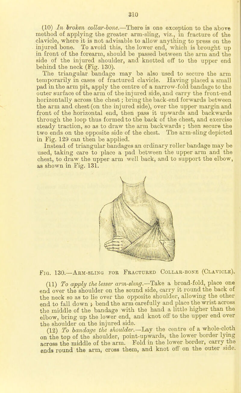 (10) In broken collar-bone.—There is one exception to the above method of applying the greater arm-sling, viz., in fracture of the clavicle, where it is not advisable to allow anything to press on the injured bone. To avoid this, the lower end, which is brought up in front of the forearm, should be passed between the arm and the side of the injured shoulder, and knotted oflf to the upper end behind the neck (Fig. 130). The triangular bandage may be also used to secure the arm temporarily in cases of fractured clavicle. Having placed a small pad in the arm pit, apply the centre of a narrow-fold bandage to the outer surface of the arm of the injured side, and carry the front-end horizontally across the chest; bring the back-end forwards between the arm and chest (on the injured side), over the upper margin and front of the horizontal end, then pass it upwards and backwards through the loop thus formed to the back of the chest, and exercise steady traction, so as to draw the arm backwards ; then secure the two ends on the opposite side of the chest. The arm-shng depicted in Fig. 129 can then be applied. Instead of triangular bandages an ordinary roller bandage may be used, taking care to place a pad between the upper arm and the chest, to draw the upper arm well back, and to support the elbow, as shown in Fig. 131. Fig. 130.—Arm-sling for Fractured Collar-boke (Clavicle). (11) To apply the lesser ann-shng.—Take a broad-fold, place one end over the shoulder on the sound side, carry it round the back of the neck so as to lie over the opposite shoulder, allowing the other end to fall down ; bend the arm carefully and place the wrist across the middle of the bandage with the hand a little higher than the elbow, bring up the lower end, and knot oil' to the upper end over the shoulder on the injured side. (12) To bandage the shoulder.—L&y the centre of a whole-cloth on the top of the shoulder, point-upwards, the lower border lying across the middle of the arm. Fold in the lower border, carry the ends round the arm, cross them, and knot off on the outer side.