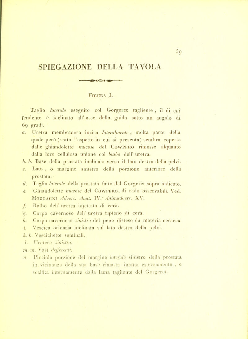 SPIEGAZIONE BELLA TAVOLA FiGURA I. Tagllo laierale esep;iiito col Gorgeret tagliente , il di ciii fendente e iuclinato all' asse della gaida sotto uii angola di 6g gradi. a. Uretra membranosa incisa lateralmente ; molta parte della quale pero (sotto Faspetto in cni si presenta) sembra coperta dalle ghiandolette mucose del Cowpkro rimosse alquanto dalla loro cellulosa unione col hidho dell' uretra. h. h. Base della prostata inclinata verso il lato destro della pelvi. c. Lato , o marginc sinistro della porzione aiiteriore della prostata. ch Taglio laierale della prostata fatto dal Gorgeret sopra indicate. e. Ghiandolette mucose del CoWPERO, di rado osservabili. Ved, MOKGAGNI Aihers. Anat. IV/ Animadi^ers. XV. /. Bli1I)0 deir nretra iujettato di cera. g. Corpo cavernoso delT uretra ripieno di cera. h. Corpo cavernoso sinistro del pene disteso da materia ceracea. I. Vescica orinaria inclinata sol lato destro della pelvi. k. k. Vescicbette serainali. /. Uretere sinistro. m. m. Vasi deiferenti. n. Picciola porzione del margine latcrale sinistro della prostata in vicinanza della sua base rirnasta inratta esrenianiente , e scalfita interiiaiiieate daila lama tagliente del Gorgeret.