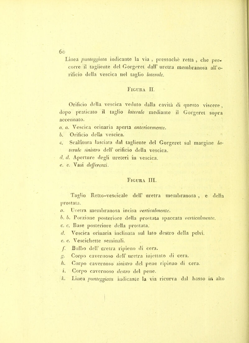 Linea punteggiata iiidicante la via , pressoche retta , clie per- corre il tagliente del Corgeret dall' iiretra membranosa airo-^ rificio della vescica nel tagllo laterale, FlGURA II. Orlftcio della vescica veduto dalla cavita di qnesto viscera , dopo praticato il taglio latemle mediante il Gorgeret sopra accennato. a. a. Vescica orinaria aperta anteriormente. b. Orificio della vescica. c. Scalfitnra lasciata dal tagliente del Gorgeret sal margine la- terale sinistro dell' oriftcio della vescica. d. d. Aperture degli ureteri in vescica. €, e. Vasi dejferenti. FiGURA. III. Taglio Retto-vescicale delF uretra membranosa , e della prostata. a. Uretra membranosa incisa i>erticalm.ente. h. b. Porzione posteriore della prostata spaccata venicalmente. c. c. Base posteriore della prostata. d. Vescica orinaria inclinata sul lato de&tro della pelvi. e. €. Vescichette seminali. /• Bulbo deir uretra ripieno di cera. g- Corpo cavernoso dell' m'etra injettato di cera. h. Corpo cavernoso sinistro del pene ripieno di cera. i. Corpo cavernoso destro del pene. L Linea punteggiata indicante la via ricnrva dal basso in alto