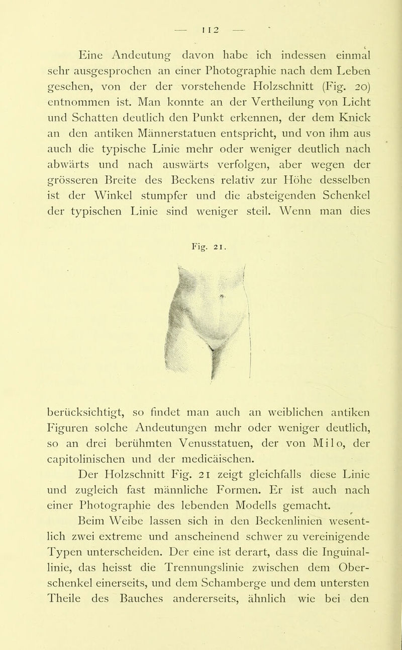 Eine Andeutung davon habe ich indessen einmal sehr ausgesprochen an einer Photographie nach dem Leben gesehen, von der der vorstehende Holzschnitt (Fig. 20) entnommen ist. Man konnte an der Vertheilung von Licht und Schatten deutlich den Punkt erkennen, der dem Knick an den antiken Männerstatuen entspricht, und von ihm aus auch die typische Linie mehr oder weniger deutlich nach abwärts und nach auswärts verfolgen, aber wegen der grösseren Breite des Beckens relativ zur Höhe desselben ist der Winkel stumpfer und die absteigenden Schenkel der typischen Linie sind weniger steil. Wenn man dies berücksichtigt, so findet man auch an weiblichen antiken Figuren solche Andeutungen mehr oder weniger deutlich, so an drei berühmten Venusstatuen, der von Milo, der capitolinischen und der medicäischen. Der Holzschnitt Fig. 21 zeigt gleichfalls diese Linie und zugleich fast männliche Formen. Er ist auch nach einer Photographie des lebenden Modells gemacht. Beim Weibe lassen sich in den Beckenlinien wesent- lich zwei extreme und anscheinend schwer zu vereinigende Typen unterscheiden. Der eine ist derart, dass die Inguinal- linie, das heisst die Trennungslinie zwischen dem Ober- schenkel einerseits, und dem Schamberge und dem untersten Theile des Bauches andererseits, ähnlich wie bei den