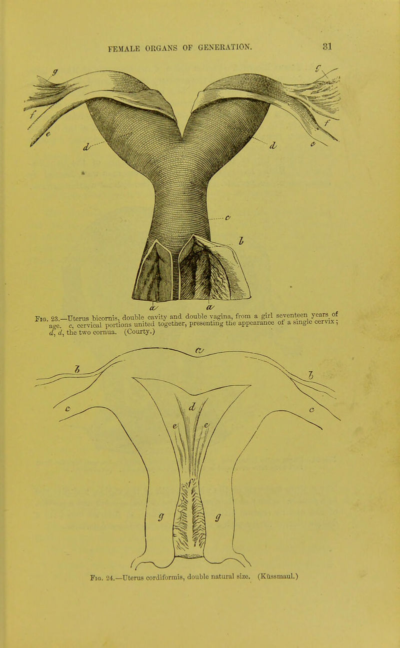 Fio. 24.—Uterus cordiforrnis, double natural size. (Kilssmaul.)