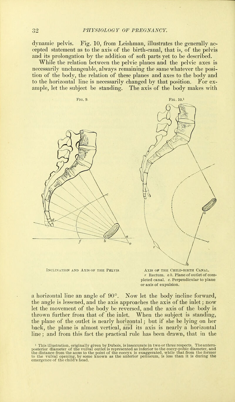 dynamic pelvis. Fig. 10, from Leishman, illustrates the generally ac- cepted statement as to the axis of the birth-canal, that is, of the pelvis and its prolongation by the addition of soft parts yet to be described. While the relation between the pelvic planes and the pelvic axes is necessarily unchangeable, always remaining the same whatever the posi- tion of the body, the relation of these planes and axes to the body and to the horizontal line is necessarily changed by that position. For ex- ample, let the subject be standing. The axis of the body makes with Fig. 9. Fig. lO.^ \V6 Inclination and Axis of the Pelvis. Axis op the Child-birth Canal. r Rectum, a ft. Plane of outlet of com- pleted canal, e. Perpendicular to plane or axis of expulsion. a horizontal line an angle of 90°. Now let the body incline forward, the angle is lessened, and the axis approaches the axis of the inlet; now let the movement of the body be reversed, and the axis of the body is thrown further from that of the inlet. When the subject is standing, the plane of the outlet is nearly horizontal; but if she be lying on her back, the plane is almost vertical, and its axis is nearly a horizontal line; and from this fact the practical rule has been drawn, that in the 1 This illustration, originally given by Dubois, is inaccurate in twoor tbree respects. Theantero- posterior diameter of the vulval outlet is represented as inferior to the coccy-pubic diameter, and the distance from the anus to the point of the coccyx is exaggerated, while that from the former to the vulval opening, by some known as the anterior perineum, is less than it is during the emergence of the child's head.