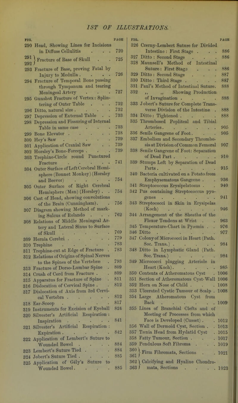 Fia. 290 Head, Showing Lines for Incisions in Diffuse Cellulitis • . . I Fracture of Base of Skull . 292 J 293 Fracture of Base, proving Fatal by Injury to Medulla . . . . 294 Fracture of Temporal Bone passing through Tympanum and tearing Meningeal Artery 295 Gunshot Fracture of Vertex: Splin- tering of Outer Table . . . 296 Ditto, natural size .... 297 Depression of External Table . . 298 Depression and Fissuring of Internal Table in same case 299 Bone Elevator 300 Hey's Saw 301 Application of Cranial Saw . . 302 Horsley's Bone-Forceps . 303 Trephine-Circle round Punctured Fracture 304 Outer Surface of Left Cerebral Hemi- sphere (Bonnet Monkey) (Horsley and Beevor) .... 305 Outer Surface of RigM Cerebral Hemisphere (Man) (Horsley) . . 306 Cast of Head, showing convolutions of the Brain (Cunningham). 307 Diagram showing Method of mark- ing Sulcus of Rolando . . . 308 Relations of Middle Meningeal Ar- tery and Lateral Sinus to Surface of Skull 309 Hernia Cerebri 310 Trephine 311 Trephine-cut at Edge of Fracture . 312 Relations of Origins of Spinal Nerves to the Spines of the Vertebra? 313 Fracture of Dorso-Lumbar Spine . 314 Crush of Cord from Fracture . 315 Apparatus for Fracture of Spine . 316 Dislocation of Cervical Spine . 317 Dislocation of Axis from 3rd Cervi- cal Vertebra 318 Ear-Scoop 319 Instruments for Excision of Eyeball 320 Silvester's Artificial Respiration : Inspiration ..... o21 Silvester's Artificial Respiration : Expiration 322 Application of Lembert's Suture to Woimded Bowel . . . . 323 Lembert's Suture Tied . 324 Jobert's Suture Tied . 325 Application of Gely's Suture to Wounded Bowel.... PAGE 720 725 726 727 732 732 733 733 738 739 739 739 741 754 754 I 1 756 762 769 779 783 783 793 809 809 811 812 812 817 824 841 842 884 884 885 885 329 330 331 332 Fia. PAGE 326 Czerny-Lembert Suture for Divided Intestine: First Stage . . . 886 327 Ditto : Second Stage . . .886 328 Maunsell's Method of Intestinal Suture: First Staga . . . 886 Ditto: Second Stage . . .887 Ditto: Third Stage . . . . 887 Paul's Method of Intestinal Suture. 888 ,, ,, Showing Production of Invagination .... 888 333 J obert's Suture for Complete Trans- verse Division of the Intestine . 888 334 Ditto: Tightened . . . .888 335 Thrombosed Popliteal and Tibial Arteries. . .... 905 336 Senile Gangrene of Foot. . .905 337 Embolism and Secondary Thrombo- sis at Division of Common Femoral 907 338 Senile Gangrene of Foot: Separation of Dead Part 910 339 Stumps Left by Separation of Dead Parts 915 340 Bacteria cultivated on a Potato from Emphysematous Gangrene . . 936 341 Streptococcus Erysipelatosus . . 940 342 Pus containing Streptococcus pyo- genes . . . . . . 941 343 Streptococci in Skin in Erysipelas (Koch) 946 344 Arrangement of the Sheaths of the Flexor Tendons at Wrist . . 963 345 Temperature-Chart in Pyaimia . . 976 346 Ditto 977 347 Colony of Micrococci in Heart (Path. Soc. Trans.) 984 348 Ditto in Lymphatic Gland (Path. Soc. Trans.) . . . .984 349 Micrococci plugging Arteriole in Heart (Koch). . ... 985 350 Contents of Atheromatous Cyst . 1006 351 Section of Atheromatous Cyst-Wall 1006 352 Horn on Nose of Child . . . 1008 353 Ulcerated Cystic Tumour of Scalp . 1008 354 Large Atheromatous Cyst from Back 1009 355 Lines of Branchial Clefts and of Meeting of Processes from which Face is Developed (Cusset) . 356 Wall of Dermoid Cyst, Section . 357 Tnenia Head from Hydatid Cyst 358 Fatty Tumour, Section . 359 Pendulous Soft Fibroma . \ Firm Fibromata, Sections 361 J 362 \ Calcifying and Hyaline Cliondro- 363 ; mata, Sections . . . . 1012 1013 1015 1017 1019 1021 1023