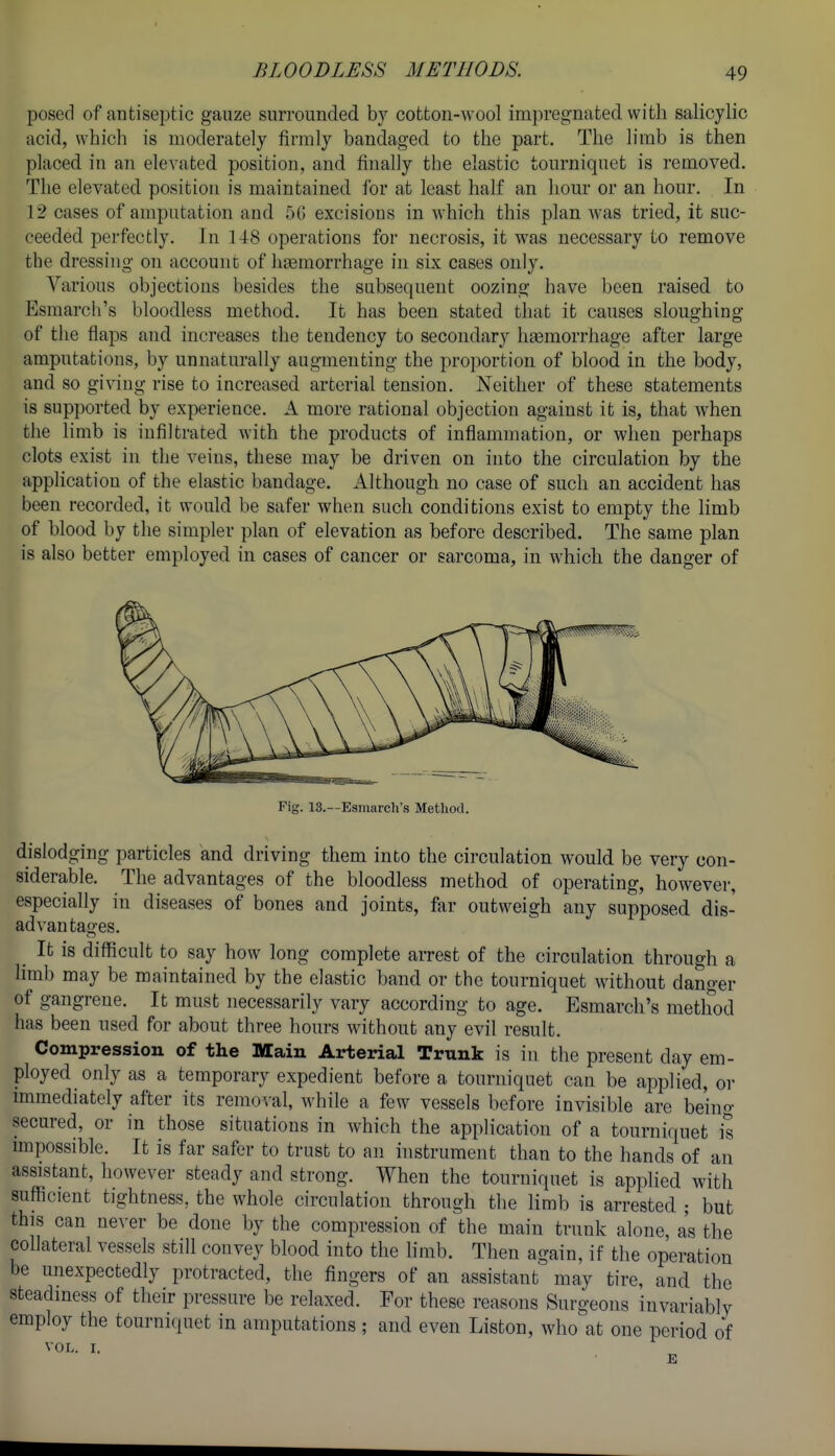 BLOODLESS METHODS. posed of antiseptic gauze surrounded by cotton-wool impregnated with salicylic acid, which is moderately firmly bandaged to the part. The limb is then placed in an elevated position, and finally the elastic tourniquet is removed. The elevated position is maintained for at least half an hour or an hour. In 12 cases of amputation and 5G excisions in Avhich this plan was tried, it suc- ceeded perfectly. In 148 operations for necrosis, it was necessary to remove the dressing on account of liajmorrhage in six cases only. Various objections besides the subsequent oozing have been raised to Esmarch's bloodless method. It has been stated that it causes sloughing of the flaps and increases the tendency to secondary haemorrhage after large amputations, by unnaturally augmenting the ])roportion of blood in the body, and so giving rise to increased arterial tension. Neither of these statements is supported by experience. A more rational objection against it is, that when the limb is infiltrated with the products of inflammation, or when perhaps clots exist in the veins, these may be driven on into the circulation by the application of the elastic bandage. Although no case of such an accident has been recorded, it would be safer when such conditions exist to empty the limb of blood by the simpler plan of elevation as before described. The same plan is also better employed in cases of cancer or sarcoma, in which the danger of Fig. 13.—Eamarch's Method. dislodging particles and driving them into the circulation would be very con- siderable. The advantages of the bloodless method of operating, however, especially in diseases of bones and joints, far outweigh any supposed dis- advantages. It is difficult to say how long complete arrest of the circulation through a limb may be maintained by the elastic band or the tourniquet without danger of gangrene. It must necessarily vary according to age. Esmarch's method has been used for about three hours without any evil result. Compression of the Main Arterial Trunk is iu the present day em- ployed only as a temporary expedient before a tourniquet can be applied, or immediately after its removal, while a few vessels before invisible are beino- secured, or in those situations in which the application of a tourniquet is impossible. It is far safer to trust to an instrument than to the hands of an assistant, however steady and strong. When the tourniquet is applied with sufficient tightness, the whole circulation through the limb is arrested ; but this can never be done by the compression of the main trunk alone, as the collateral vessels still convey blood into the limb. Then again, if the operation be unexpectedly protracted, the fingers of an assistant may tire, and the steadiness of their pressure be relaxed. For these reasons Surgeons invariably employ the tourniquet in amputations ; and even Liston, who at one period of VOL. I.