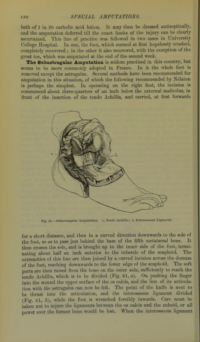 bath of 1 iu 20 carbolic acid lotion. It may then be dressed antiseptically, and the amputation deferred till the exact limits of the injury can be clearly ascertained. This line of practice was followed in two cases in University College Hospital. In one, the foot, which seemed at first hopelessly crushed, completely recovered ; in the other it also recovered, with the exception of the great toe, which was amputated at the end of the second week. The Subastragalar Amputation is seldom practised in this country, but seems to be more commonly adopted in France. In it the whole foot is removed except the astragalus. Several methods have been recommended for amputation in this situation, of which the following recommended by Nelaton is perhaps the simplest. In operating on the right foot, the lucision is commenced about three-quarters of an inch below the external malleolus, in front of the insertion of the tendo Achillis, and carried, at first forwards Fig. 61.—Subastragalar Amputation, c, Tendo Acliillis ; h, Tntero.sseous Ligament for a short distance, and then in a curved direction downwards to the sole of the foot, so as to pass just behind the base of the fifth metatarsal bone. It then crosses the sole, and is brought up to the inner side of the foot, termi- nating about half an inch anterior to the tubercle of the scaphoid. The extremities of this line are then joined by a curved incision across the dorsum of the foot, reaching downwards to the lower edge of the scaphoid. The soft parts are then raised from the bone on the outer side, sufficiently to reach the tendo Achillis, which is to be divided (Fig. 61, a). On pushing the finger into the wound the upper surface of the os calcis, and the line of its articula- tion with the astragalus can now be felt. The point of the knife is next to be thrust into the articulation, and the interosseous ligament divided (Fig. 61, V), while the foot is wrenched forcibly inwards. Care must be taken not to injure the ligaments between the os calcis and the cuboid, or all power over the former bone would be lost. When the interosseous ligament