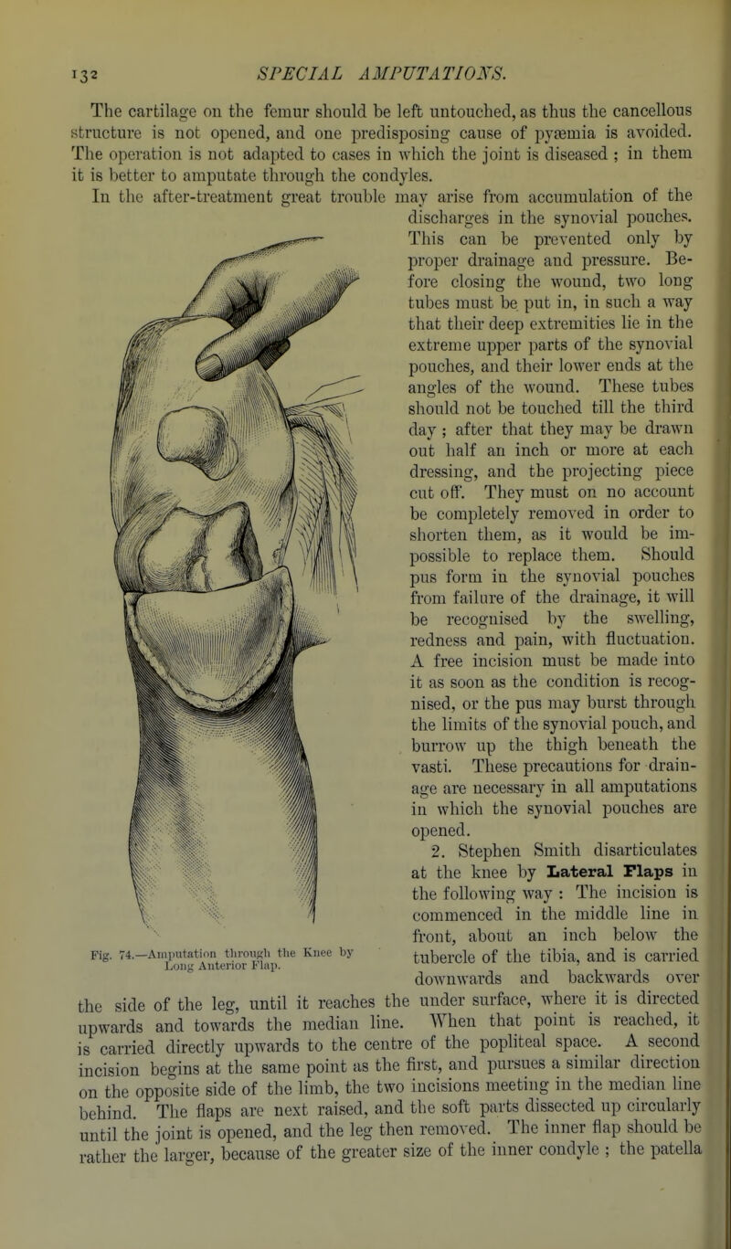 The cartilage on the femur should be left untouched, as thus the cancellous structure is not opened, and one predisposing cause of pyEemia is avoided. The operation is not adapted to cases in which the joint is diseased ; in them it is better to amputate through the condyles. In the after-treatment great trouble may arise from accumulation of the discharges in the synovial pouches. This can be prevented only by proper drainage and pressure. Be- fore closing the wound, two long tubes must be put in, in such a way that their deep extremities lie in the extreme upper parts of the synovial pouches, and their lower ends at the ano'les of the wound. These tubes should not be touched till the third day ; after that they may be drawn out half an inch or more at each dressing, and the projecting piece cut off. They must on no account be completely removed in order to shorten them, as it would be im- possible to replace them. Should pus form in the synovial pouches from failure of the drainage, it will be recognised by the swelling, redness and pain, with fluctuation. A free incision must be made into it as soon as the condition is recog- nised, or the pus may burst through the limits of the synovial pouch, and burrow up the thigh beneath the vasti. These precautions for drain- age are necessary in all amputations in which the synovial pouches are opened. 2. Stephen Smith disarticulates at the knee by Lateral Flaps in the following way : The incision is commenced in the middle line in front, about an inch below the tubercle of the tibia, and is carried downwards and backwards over the side of the leg, until it reaches the under surface, where it is directed upwards and towards the median line. AYhen that point is reached, it is carried directly upwards to the centre of the pophteal space. A second incision begins at the same point as the first, and pursues a similar direction on the opposite side of the limb, the two incisions meeting in the median line behind. The flaps are next raised, and the soft parts dissected up circularly until the joint is opened, and the leg then removed. The inner flap should be rather the larger, because of the greater size of the inner condyle ; the patella Fig. 74.—Amputation tlirouKli the Knee by Long Anterior Flap.