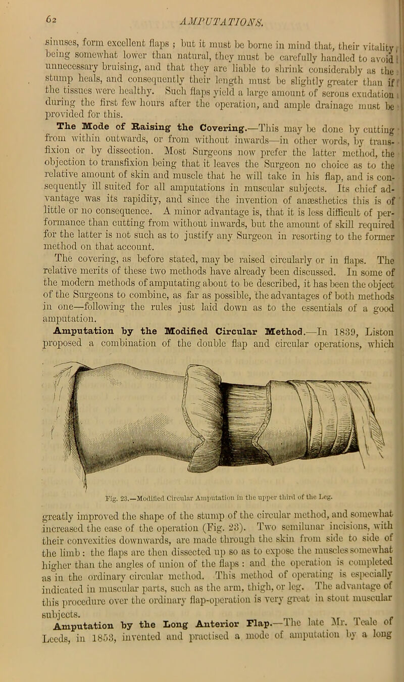 sinuses, form excellent flaps ; but it must be borne in mind that, their vitality, bemg somewhat lower than natural, they must be carefully handled to avoid ' ' unnecessary bruising, and that they are liable to shrink considerably as the • stump heals, and consequently their length must be slightly greater than if the tissues were healthy. Such flaps yield a large amount of serous exudation | during the first few hours after the operation, and ample drainage must lie [ provided for this. The Mode of Raising the Covering.—This may lie done by cutting j from within outwards, or from without inwards—in other words, by trails- fixion or by dissection. Most Surgeons now prefer the latter method, the 1 objection to transfixion being that it leaves the Surgeon no choice as to the relative amount of skin and muscle that he will take in his flap, and is con- j scquently ill suited for all amputations in muscular subjects. Its chief ad- vantage was its rapidity, and since the invention of anaesthetics this is of little or no consequence. A minor advantage is, that it is less difficult of per- formance than cutting from without inwards, but the amount of skill required for the latter is not such as to justify any Surgeon in resorting to the former method on that account. The covering, as before stated, may be raised circularly or in flaps. The relative merits of these two methods have already been discussed. In some of the modern methods of amputating about to be described, it has been the object of the Surgeons to combine, as far as possible, the advantages of both methods in one—following the rules just laid down as to the essentials of a good amputation. Amputation by the Modified Circular Method.—In 1839, Liston proposed a combination of the double flap and circular operations, which greatly improved the shape of the stump of the circular method, and somewhat increased the ease of the operation (Fig. 23). Two semilunar incisions, with their convexities downwards, are made through the skin from side to side of the limb: the flaps are then dissected up so as to expose the muscles somewhat higher than the angles of union of the flaps : and the operation is completed as in the ordinary circular method. This method of operating is especially indicated in muscular parts, such as the arm, thigh, or leg. The advantage of this procedure over the ordinary flap-operation is very great in stout muscular Amputation by the Long Anterior Flap.—The late Mr. Tealc of Leeds, in 1853, invented and practised a mode of amputation by a long