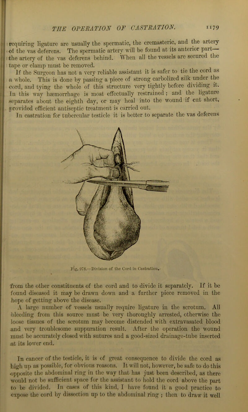 3 I requiring ligature are usually the spermatic, the cremasteric, and the arteiy < ot the vas deferens. The spermatic artery will be found at its anterior part I the arteiy of the vas deferens behind, A\hen all the vessels are secured the tape or clamp must he removed. If the Surgeon has not a very reliable assistant it is safer to tie the cord as ii whole. This is done by passing a piece of strong carbolized silk under the cord, and tying the whole of this structure very tightly before dividing it. lu this way hmmorrhage is most effectually restrained; and the ligature separates about the eighth day, or may heal into the wound if cut short, , provided efficient antiseptic treatment is carried out. J n castration for tubercular testicle it is better to separate the vas deferens from the other constituents of the cord and to divide it separately. If it be found diseased it may be drawn down and a further piece removed in the hope of getting above the disease. A large number of vessels usually require ligature in the scrotum. All lileeding from this source must be very thoroughly arrested, otherwise the loose tissues of the scrotum may become distended with extravasated blood and very troublesome suppuration result. After the operation the wound must be accurately closed with sutures and a good-sized drainage-tube inserted ut its lower end. In cancer of the testicle, it is of great consequence to divide the cord a.s high up as possible, for obvious reasons. It will not, however, be safe to do this •^jpposite the abdominal ring in the way that has just been described, as there would not be sufficient sj)ace for the assistant to hold the cord alx)ve the part to lx; divided. In cases of this kind, I have found it a good practice to expose the cord by dissection up to the abdominal ring ; then to draw it well