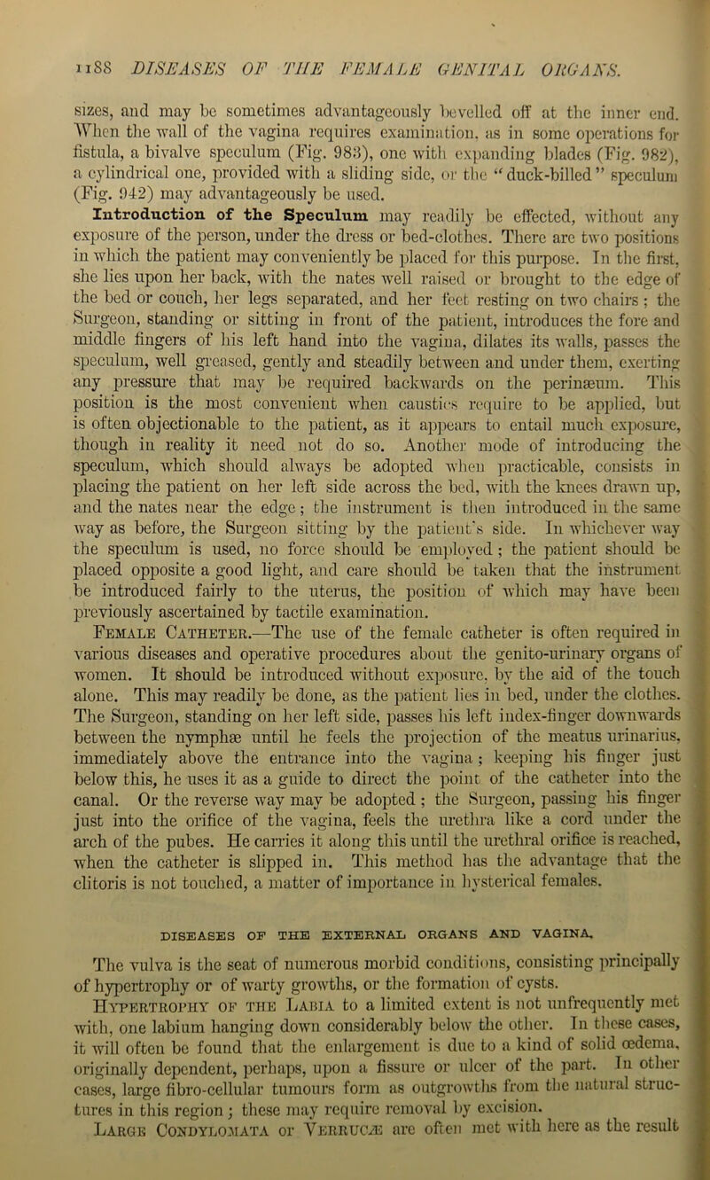 sizes, and may be sometimes advantageously lievelled off at the inner end. When the wall of the vagina requires examiniition. as in some operations foi- fistula, a bivalve speculum (Fig. 988), one with expanding blades (Fig. 982), a cylindrical one, provided with a sliding side, or the “duck-billed” speculum (Fig. 942) may advantageously be used. Introduction of the Speculum may readily be effected, without any exposure of the person, under the dress or bed-clothes. There are two positions in which the patient may conveniently be placed for this purpose. Tn the first, she lies upon her back, with the nates well raised or brought to the edge of the bed or couch, her legs separated, and her feet resting on two chairs ; the Surgeon, standing or sitting in front of the patient, introduces the fore and middle fingers of his left hand into the vagina, dilates its walls, passes the speculum, well greased, gently and steadily between and under them, exerting any j)ressm’e that may be required backwards on the perinmum. This position is the most convenient when caustics require to be applied, but is often objectionable to the patient, as it appears to entail much exposure, though in reality it need not do so. AnoUier mode of introducing the speculum, which should always be adopted when practicable, consists in placing the patient on her left side across the bed, with the knees drawn up, and the nates near the edge; the instrument is then introduced in the same way as before, the Surgeon sitting by the patient's side. In whichever way the speculum is used, no force should be emi)luyed ; the patient should be placed opposite a good light, and care should be taken that the instrument be introduced fairly to the uterus, the position of which may have been ]3i*eviously ascertained by tactile examination. Female Catheter.—The use of the female catheter is often required in various diseases and operative procedures about the genito-urinary organs of women. It should be introduced without exposure, by the aid of the touch alone. This may readily be done, as the patient lies in bed, under the clothes. The Surgeon, standing on her left side, passes his left index-finger do'ivnwards between the nymphae until he feels the projection of the meatus urinarius, immediately above the entrance into the vagina; keeping his finger just below this, he uses it as a guide to direct the point, of the catheter into the canal. Or the reverse way may be adopted ; the Surgeon, passing his finger just into the orifice of the vagina, feels the urethra like a cord under the arch of the pubes. He carries it along this until the urethral orifice is reached, when the catheter is slipped in. This method has the advantage that the clitoris is not touched, a matter of importance in hysterical females. DISEASES OF THE EXTERNAL ORGANS AND VAGINA. The vulva is the seat of numerous morbid conditions, consisting principally of hypertrophy or of warty growths, or the formation ot cysts. Hypertrophy of the Laiha to a limited extent is not unfrequently met with, one labium hanging down considerably below the other. In these cases, it will often be found that the enlargement is due to a kind of solid oedema, originally dependent, perhaps, upon a fissure or ulcer ot the part, lu other cases, large fibro-cellular tumours form as outgrowths trom the natural struc- tures in this region ; these may require removal by excision. Large Condylo^iata or Verructe arc often met with here as the result