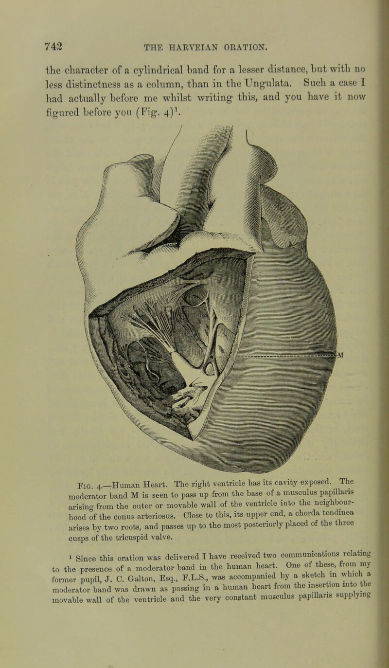 the character of a cylindrical band for a lesser distance, but witli no less distinctness as a column, than in the Ung-ulata. Such a case I had actually before me whilst writing this, and you have it now figured before you (Fig. 4)''. Fig. 4.—Human Heart. The right ventricle has its cavity exposed. The moderator band M is seen to pass up from the base of a musculus papUlaris arising from the outer or movable wall of the ventricle into the neighbour- hood of the conus arteriosus. Close to this, its upper end, a chorda tendmea arises by two roots, and passes up to the most posteriorly placed of the three cusps of the tricuspid valve. » Since this oration was delivered I have received two communications relating to the presence of a moderator band in the human heart. One of these, from my former pupil, J. C. Galton, Esq., F.L.S., was accompanied by a sketch m which a moderator band was drawn as passing in a human heart f.om the msert.on into tl>e movable wall of the ventricle and the very constant musculus papillaris supplying