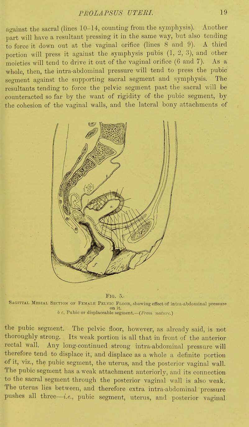 against the sacral (lines 10-U, counting from the symphysis). Anotlier part will have a resultant pressing it in the same way, but also tending to force it down out at the vaginal orifice (lines 8 and 9). A third portion will press it against the symphysis pubis (1, 2, 3), and other moieties will tend to drive it out of the vaginal orifice (6 and 7). As a whole, then, the intra-abdominal pressure will tend to press the pubic segment against the supporting sacral segment and symphysis. The resultants tending to force the pelvic segment past the sacral will be counteracted so far by the Avant of rigidity of the pubic segment, by the cohesion of the vaginal walls, and the lateral bony attachments of / Fig. o.- Sagittal Mesial Section of Female Pelvic Floor, .sliowing effect of inti a-abdominal pressure on it. h c, Pubic or displaceable segment.—(Froiii naiv.rc.') the pubic segment. The pelvic floor, however, as already said, is not thoroughly strong. Its weak portion is all that in front of the anterior rectal wall. Any long-continued strong intra-abdominal pressure will therefore tend to displace it, and displace as a whole a definite portion of it, viz., the pubic segment, the uterus, and the posterior vaginal wall. The pubic segment has a weak attachment anteriorly, and its connection to the sacral segment through the posterior vaginal wall is also weak. The uterus lies between, and therefore extra intra-abdominal pressure pushes all three—i.e.^ pubic segment, uterus, and posterior vaginal