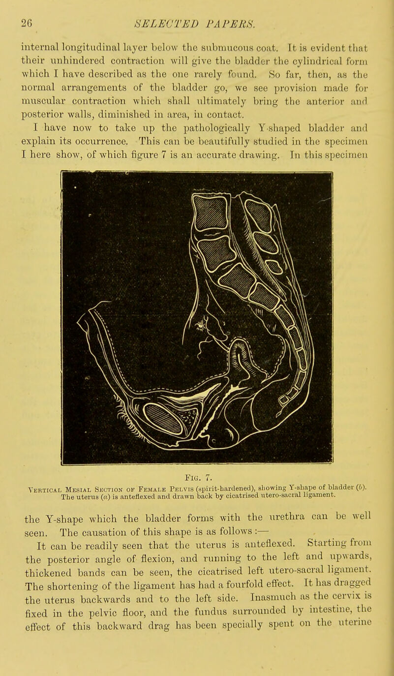 internal longitudinal layer below the submucous coat. It is evident that their unhindered contraction will give the bladder the cylindrical form which I have described as the one rarely found. So far, then, as the normal arrangements of the bladder go, we see provision made for muscular contraction which shall iiltimately bring the anterior and posterior walls, diminished in area, in contact. I have now to take up the pathologically Y-shaped bladder and explain its occurrence. This can be beautifully studied in the specimen I here show, of which figure 7 is an accurate drawing. In this specimen Fig. Verticai, Mesial Section of Female Pelvis (spirit-hardened), allowing Y-sliape of bladder (6). The uterus («) is anteflexed and drawn back by cicatrised utero-sacral ligament. the Y-shape which the bladder forms with the urethra can be well seen. The causation of this shape is as follows :— It can be readily seen that the uterus is anteflexed. Starting from the posterior angle of flexion, and running to the left and upwards, thickened bands can be seen, the cicatrised left utero-sacral ligament. The shortening of the ligament has had a fourfold efl'ect. It has drngged the uterus backwards and to the left side. Inasmuch as the cervix is fixed in the pelvic floor, and the fundus surrounded by intestine, the effect of this backward drag has been specially spent on the uterine