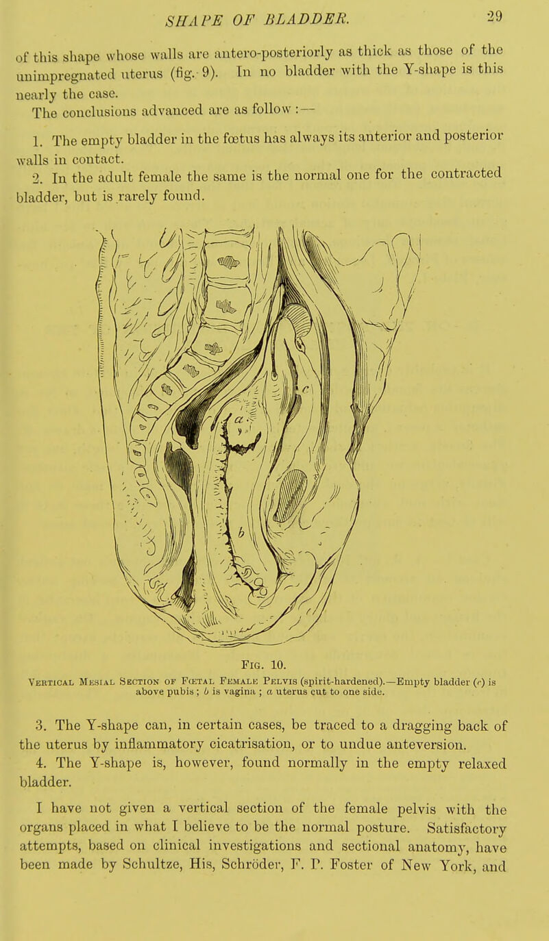 of this shape whose walls are antero-posteriorly as thick as those of the imimpregnated uterus (fig. 9). In no bladder with the Y-shape is this nearly the case. The conclusions advanced are as follow : — 1. The empty bladder in the fostus has always its anterior and posterior walls in contact. 2. In the adult female the same is the normal one for the contracted bladder, but is rarely found. Fig. 10. Vertical Mesial Section or Fcetal Female Pelvis (spirit-hardened).—Empty bladder (<■) is above pubis; b is vagina ; a uterus cut to one side. 3. The Y-shape can, in certain cases, be traced to a dragging back of the uterus by inflammatory cicatrisation, or to undue anteversion. 4. The Y-shape is, however, found normally in the empty relaxed bladder. I have not given a vertical section of the female pelvis with the organs placed in what t believe to be the normal posture. Satisfactory attempts, based on clinical investigations and sectional anatomy, have been made by Schultze, His, Schroder, F. P. Foster of New York, and