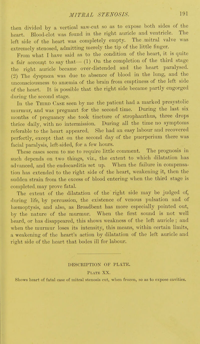 then divided by a vortical saw-cut so as to expose both sides of the heart. Blood-clot was found in the right auricle and ventricle. The left side of the heart was completely empty. The .mitral valve was extremely stenosed, admitting merely the tip of the little finger. ^ From what I have said as to the condition of the heart, it is quite a fair account to say that— (1) On the completion of the third stage the right auricle became over-distended and the heart paralysed. (2) The dyspna>a was due to absence of blood in the lung, and the unconsciousness to anajmia of the brain from emptiness of the left side of the heart. It is possible that the right side became partly engorged during the second stage. In the Third Case seen by me the patient had a marked presystolic murmur, and was pregnant for the second time. During the last six months of pregnancy she took tincture of strophanthus, three drops thrice daily, with no intermission. During all the time no symptoms referable to the heart appeared. She had an easy labour and recovered perfectly, except that on the second day of the puerperium there was facial paralysis, left-sided, for a few hours. These cases seem to me to require little comment. The prognosis in such depends on two things, viz., the extent to which dilatation has advanced, and the endocarditis set up. When the failure in compensa- tion has extended to the right side of the heart, weakening it, then the sudden strain from the excess of blood entering when the third stage is completed, may prove fatal. The extent of the dilatation of the right side may be judged of, during life, by percussion, the existence of venous pulsation and of haemoptysis, and also, as Broadbent has more especially pointed out, by the nature of the murmur. When the first sound is not well beard, or has disappeared, this shows weakness of the left auricle; and when the murmur loses its intensity, this means, within certain limits, a weakening of the heart's action by dilatation of the left auricle and right side of the heart that bodes ill for labour. DESCRIPTION OF PLA.TE, Plate XX. Shows heart of fatal case of mitral stenosis cut, when frozen, so as to expose cavities.