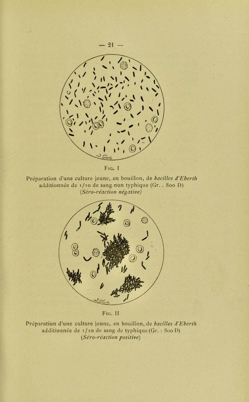 / — 21 — Preparation d’une culture jeune, en bouillon, de bacilles d’Eberth additionnee de i/io de sang non typhique (Gr. . 800 D) {Sero-reaction negative) Fig. II Preparation d’une culture jeune, en bouillon, de bacilles d'Eberth additionnee de 1/10 de sang de typhique (Gr. : 800 D) {Sero-reaction positive)