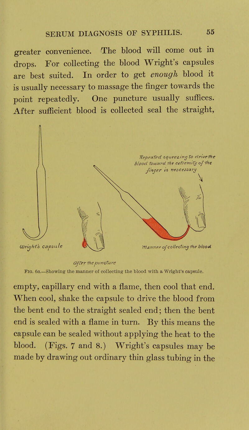 greater convenience. The blood will come out in drops. For collecting the blood Wright's capsules are best suited. In order to get enough blood it is usually necessary to massage the finger towards the point repeatedly. One puncture usually suffices. After sufficient blood is collected seal the straight, TiepesTed squeezing to clriuefhe Fig. 6a Showing the manner of collecting the blood with a Wright's capsule. empty, capillary end with a flame, then cool that end. When cool, shake the capsule to drive the blood from the bent end to the straight sealed end; then the bent end is sealed with a flame in turn. By this means the capsule can be sealed without applying the heat to the blood. (Figs. 7 and 8.) Wright's capsules may be made by drawing out ordinary thin glass tubing in the