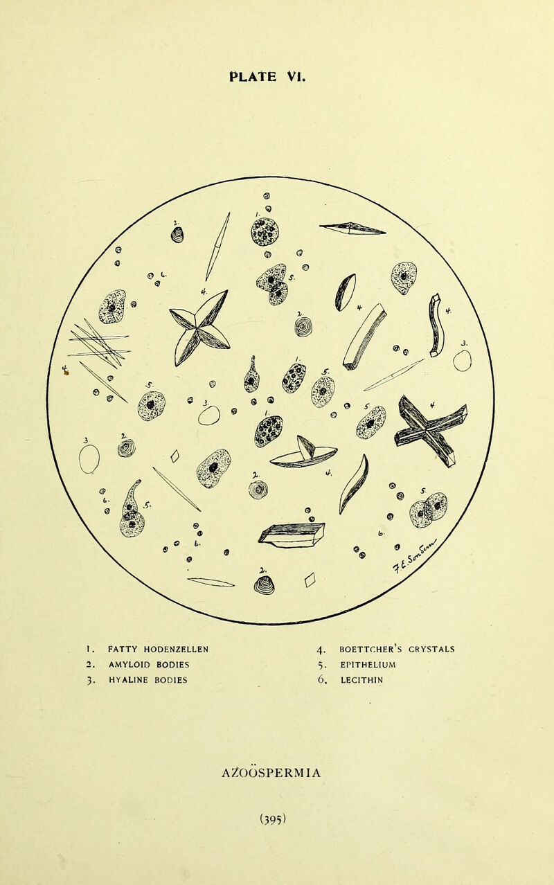 AZOOSPERMIA