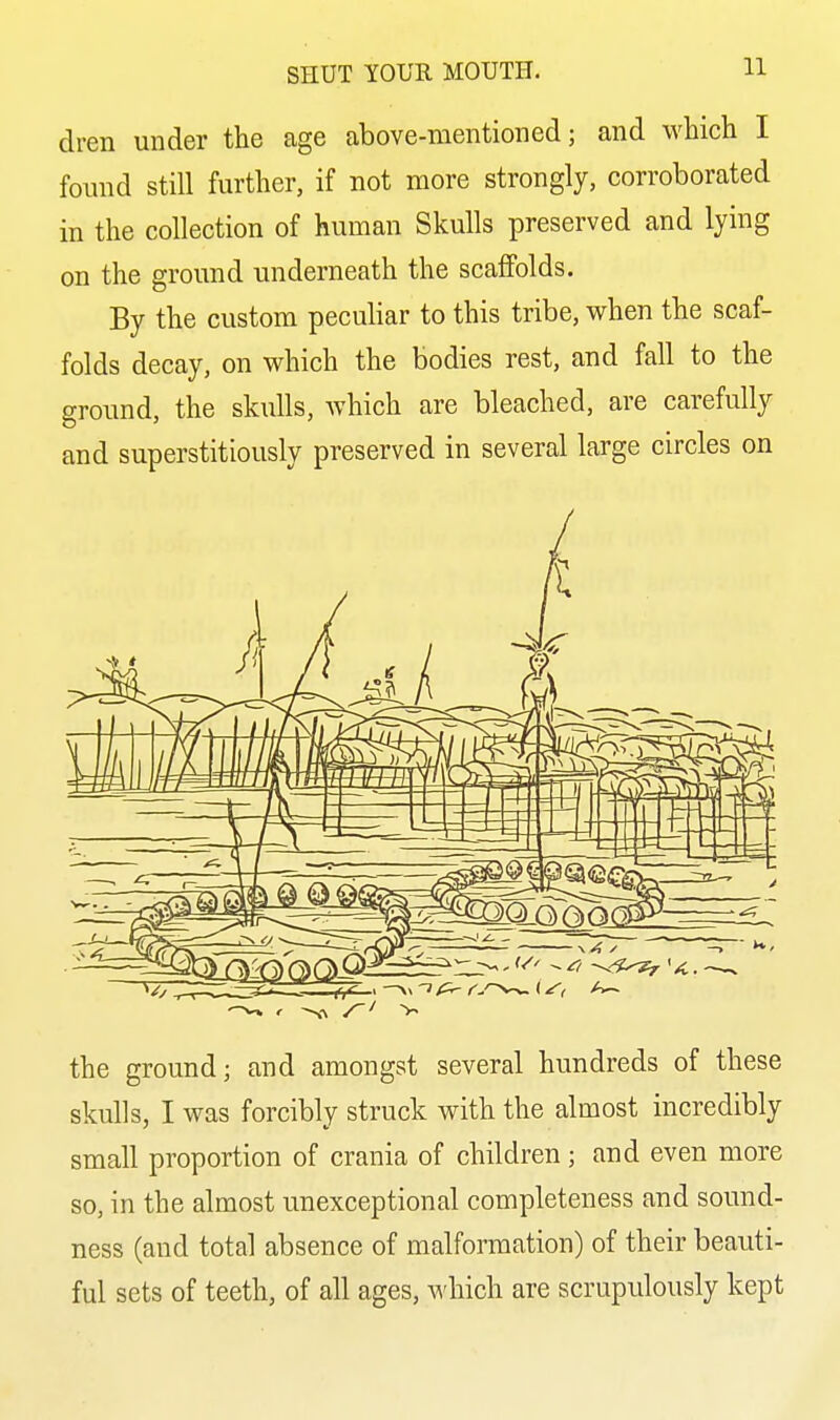 dren under the age above-mentioned; and which I found still further, if not more strongly, corroborated in the collection of human Skulls preserved and lying on the ground underneath the scaffolds. By the custom peculiar to this tribe, when the scaf- folds decay, on which the bodies rest, and fall to the ground, the skulls, which are bleached, are carefully and superstitiously preserved in several large circles on the ground; and amongst several hundreds of these skulls, I was forcibly struck with the almost incredibly small proportion of crania of children; and even more so, in the almost unexceptional completeness and sound- ness (and total absence of malformation) of their beauti- ful sets of teeth, of all ages, ^A'hich are scrupulously kept