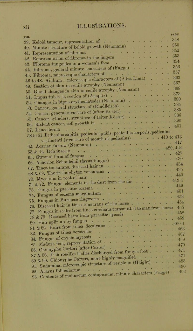 * PAGE Fi». 39. Keloid tumour, representation of 40. Minute structure of keloid growth (Neumann) ' 41. Representation of fibroma ^ 42. Representation of fibroma in the fingers 43. Fibroma fungoides in a woman’s face ' ^ 44. Fibroma, general minute characters of (Fagge) ^ 45. Fibroma, microscopic characters of . • • • • • • * ' ' _ 46 to 48. Ainhum : microscopic characters of (Silva Lima) ••••*£ 49. Section of skin in senile atrophy (Neumann) . 50. Gland changes in skin in senile atrophy (Neumann) ' 51. Lupus tubercle, section of (Auspitz) . . ' 52. Changes in lupus erythematodes (Neumann) 53. Cancer, general structure of (Rindfleisch) 54. Cancer, general structure of (after Roster) ^ 55. Cancer cylinders, structure of (after Roster) ^ 56. Rodent cancer, cell growth ’. ... 401 57. Leucoderma ’ ’ . .. , „ 58 to 61. Pediculus capitis, pediculus puhis, pediculus eorpons, pediculus vestimenti (structure of mouth of pediculus) 4,11 444 62. Acarian furrow (Neumann) 424 63 & 64. Itch insects . .  5 427 65. Stromal form of fungus • • •  66. Achorion Schonleinii (favus fungus) 4g4 67. Tinea tonsurans, diseased hair in ^ 68 & 69. The trichophyton tonsurans 44Q 70. Mycelium in root of hair ■••••••. ,,q . 71 & 72. Fungus elements in the dust from the air • ^ 73. Fungus in parasitic eczema 74. Fungus of eczema marginatum ^ 75. Fungus in Burmese ringworm • • • • 76 Diseased hair in tinea tonsurans of the horse . . ■ • ■ • ■ ■ rr 77. Fungus in scales from tinea circinata transmitted to man from horse 45o 78 & 79. Diseased hairs from parasitic sycosis ^ 80. Hair split up by fungus 460-1 81 & 82. Hairs from tinea decalvans 83. Fungus of tinea versicoloi ...•••• . . 467 84. Fungus of onychomycosis •_ • .... 469 85. Madura foot, representation of ’ ’ ’ 470 86 Chionvphe Carteri (after Carter) ••••••*'* 87 & 88. Fish roe-like bodies discharged from fungus 0 . • • • • ^ 89 & 90. Chionyphe Carteri, more lug y iTiagni e4 . ^ - . _ 4g3 91. Sudamina, microscopic structure of vesicle m (Ha 0 • m S'. CoXnWmolluscum contagiosum, minute characters (Fagge) . 492
