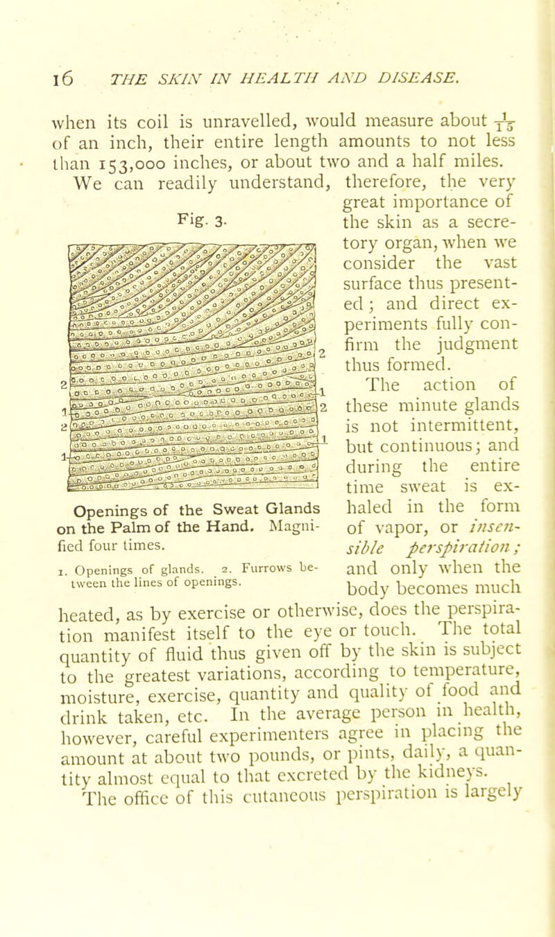 when its coil is unravelled, would measure about T\ of an inch, their entire length amounts to not less than 153,000 inches, or about two and a half miles. We can readily understand, therefore, the very Fig. 3- Openings of the Sweat Glands on the Palm of the Hand. Magni- fied four times. 1. Openings of glands. 2. Furrows be- tween the lines of openings. great importance of the skin as a secre- tory organ, when we consider the vast surface thus present- ed ; and direct ex- periments fully con- firm the judgment thus formed. The action of these minute glands is not intermittent, but continuous; and during the entire time sweat is ex- haled in the form of vapor, or insen- sible perspiration ; and only when the body becomes much heated, as by exercise or otherwise, does the perspira- tion manifest itself to the eye or touch. The total quantity of fluid thus given off by the skin is subject to the greatest variations, according to temperature, moisture, exercise, quantity and quality of food and drink taken, etc. In the average person in health, however, careful experimenters agree in placing the amount at about two pounds, or pints, daily, a quan- tity almost equal to that excreted by the kidneys. The office of this cutaneous perspiration is largely