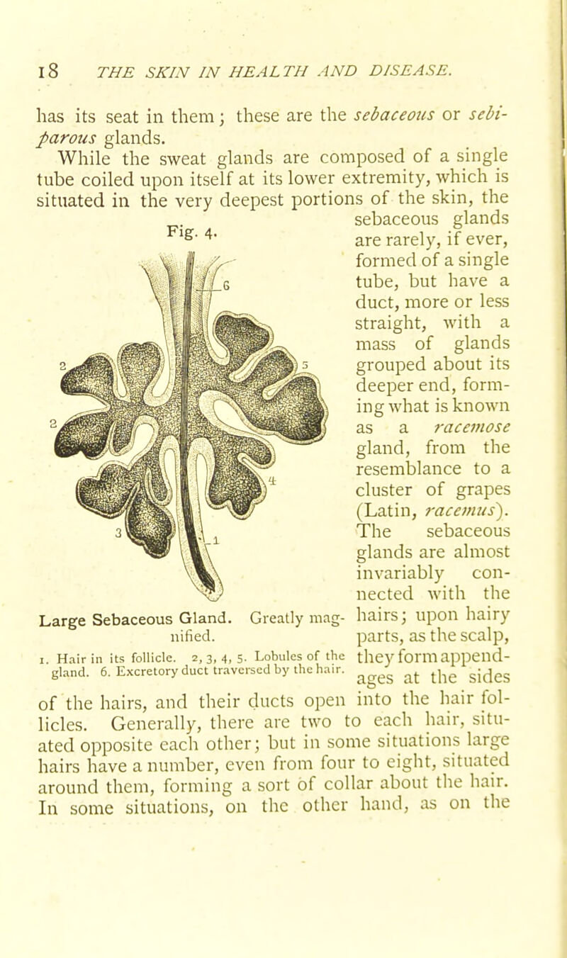 has its seat in them j these are the sebaceous or sebi- parous glands. While the sweat glands are composed of a single tube coiled upon itself at its lower extremity, which is situated in the very deepest portions of the skin, the sebaceous glands are rarely, if ever, formed of a single tube, but have a duct, more or less straight, with a mass of glands grouped about its deeper end, form- ing what is known as a racemose gland, from the resemblance to a cluster of grapes (Latin, racemus). The sebaceous glands are almost invariably con- nected with the Large Sebaceous Gland. Greatly mag- hairs; upon hairy nified. parts, as the scalp, i. Hair in its follicle. 2,3,4,5- Lobules of the they form appeild- gland. 6. Excretory duct traversed by the hair. g at ^ of the hairs, and their ducts open into the hair fol- licles. Generally, there are two to each hair, situ- ated opposite each other; but in some situations large hairs have a number, even from four to eight, situated around them, forming a sort of collar about the hair. In some situations, on the other hand, as on the Fig. 4.