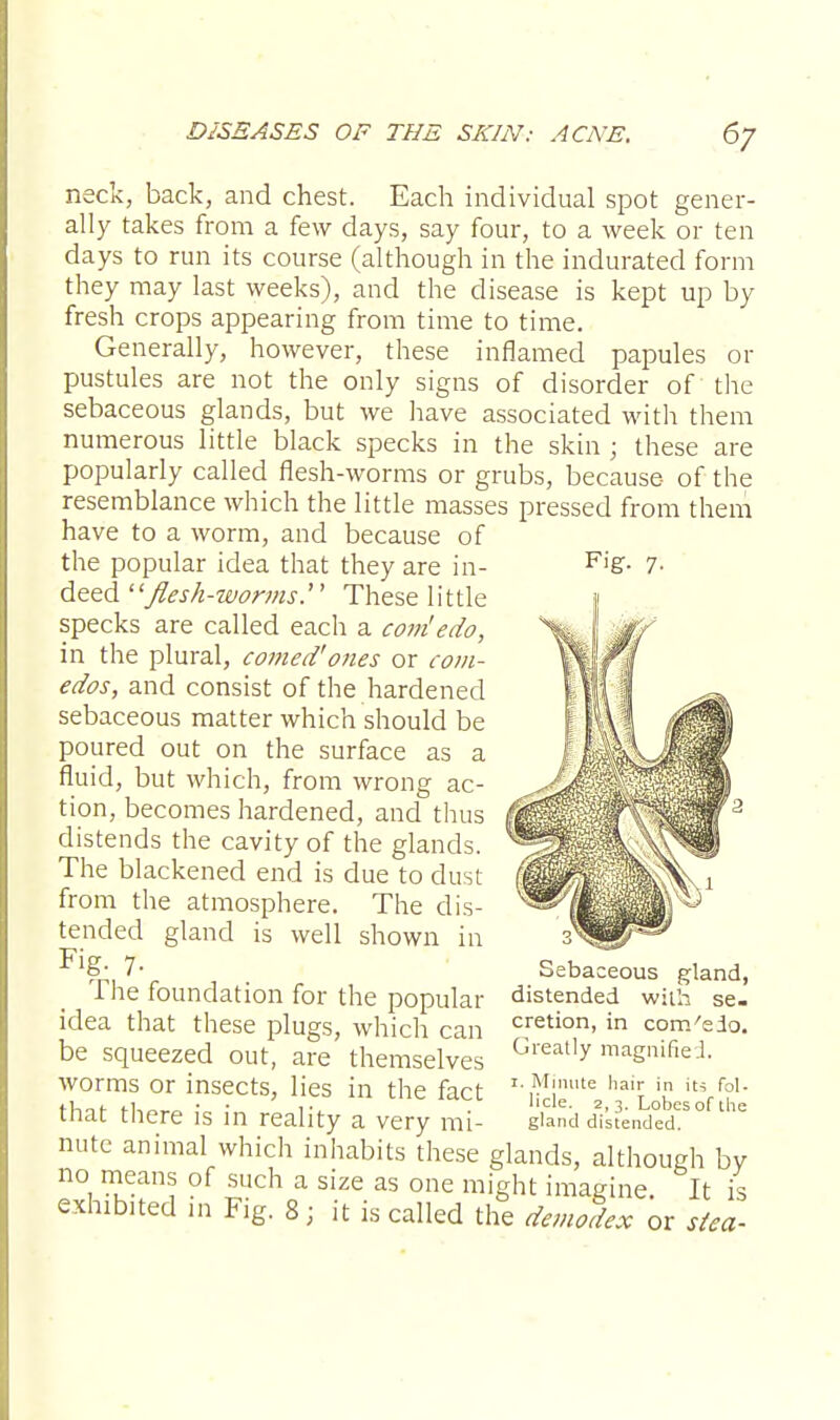 neck, back, and chest. Each individual spot gener- ally takes from a few days, say four, to a week or ten days to run its course (although in the indurated form they may last weeks), and the disease is kept up by fresh crops appearing from time to time. Generally, however, these inflamed papules or pustules are not the only signs of disorder of the sebaceous glands, but we have associated with them numerous little black specks in the skin ; these are popularly called flesh-worms or grubs, because of the resemblance which the little masses pressed from them have to a worm, and because of the popular idea that they are in- deed flesh-worms.'' These little specks are called each a com'edo, in the plural, corned'ones or com- edos, and consist of the hardened sebaceous matter which should be poured out on the surface as a fluid, but which, from wrong ac- tion, becomes hardened, and thus distends the cavity of the glands. The blackened end is due to dust from the atmosphere. The dis- tended gland is well shown in Fig. 7. The foundation for the popular idea that these plugs, which can be squeezed out, are themselves worms or insects, lies in the fact that there is in reality a very mi- Sebaceous gland, distended with se- cretion, in com'edo. Greatly magnified. 1. Minute hair in its fol- licle. 2,3. Lobes of the gland distended. nute animal which inhabits these glands, although by no means of such a size as one might imagine. It is exhibited in Fig. 8; it is called the demodex or stea-