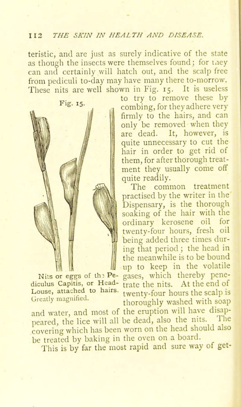 teristic, and are just as surely indicative of the state as though the insects were themselves found; for tney can and certainly will hatch out, and the scalp free from pediculi to-day may have many there to-morrow. These nits are well shown in Fig. 15. It is useless to try to remove these by combing, for they adhere very firmly to the hairs, and can only be removed when they are dead. It, however, is quite unnecessary to cut the hair in order to get rid of them, for after thorough treat- ment they usually come off quite readily. The common treatment practised by the writer in the Dispensary, is the thorough soaking of the hair with the ordinary kerosene oil for twenty-four hours, fresh oil being added three times dur- ing that period ; the head in the meanwhile is to be bound up to keep in the volatile Nits or eggs of irn Pe- gases, which thereby pene- diculus Capitis, or Head- trate the nits. At the end of Louse, attached to hairs. twenty_four hours the scalp is Greatly magnified. thoroughly washed with soap and water, and most of the eruption will have disap- peared, the lice will all be dead, also the nits. The covering which has been worn on the head should also be treated by baking in the oven on a board. This is by far the most rapid and sure way of get-