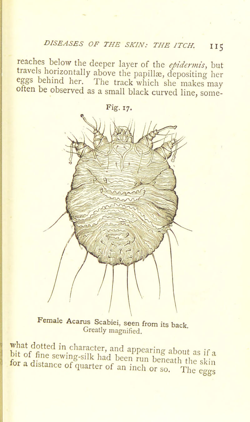 reaches below the deeper layer of the epidermis, but travels horizontally above the papillae, depositing her eggs behind her. The track which she makes may often be observed as a small black curved line, some- Fig. 17. Female Acarus Scabiei, seen from its back Greatly magnified. what dotted in character, and appearing about as if a bit of fine sewing-silk had been run beneath the skin for a distance of quarter of an inch or so The £gg