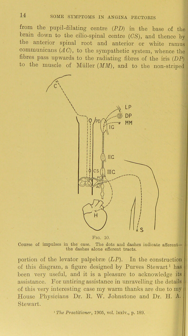 from the pupil-dilating centre (PD) in the base of the brain down to the cilio-spinal centre (CS), and thence by the anterior spinal root and anterior or white ramus communicans (AC), to the sympathetic system, whence the fibres pass upwards to the radiating fibres of the iris (DP) to the muscle of Muller {MM), and to the non-striped Pig. 10. Course of impulses in the case. The dots and dashes indicate aSerent— the dashes alone efferent tracts. portion of the levator palpebrae (DP). In the construction of this diagram, a figure designed by Purves Stewart^ has been very useful, and it is a pleasure to acknowledge its assistance. For untiring assistance in unravelling the details of this very interesting case my warm thanks are due to my House Physicians Dr. R. W. Johnstone and Dr. H. A. Stewart. ' The Practitioner, 1905, vol. Ixxiv., p. 189.