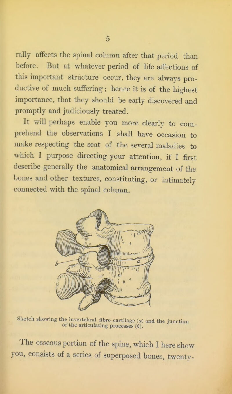rally affects the spinal column after that period than before. But at whatever period of life affections of this important structure occur, they are always pro- ductive of much suffermg; hence it is of the highest importance, that they should be early discovered and promptly and judiciously treated. It will perhaps enable you more clearly to com- prehend the observations I shall have occasion to make respecting the seat of the several maladies to which I purpose du-ecting your attention, if I first describe generally the anatomical arrangement of the bones and other textures, constituting, or intimately connected with the spinal column. Sketch showing the invertebral fibro-cnrtilage (a) and the junction of the articulating processes {//). The osseous portion of the spine, which I here show you, consists of a series of superposed bones, twenty-