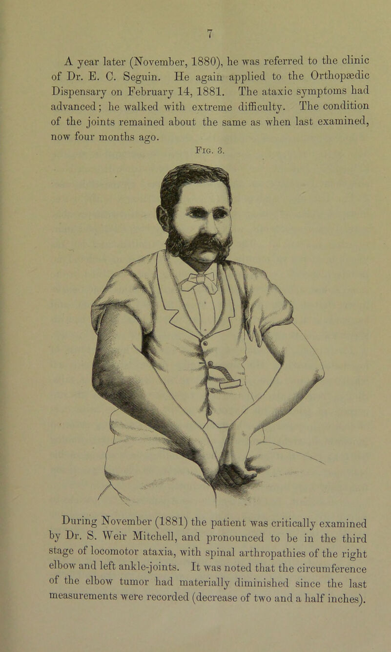 A year later (November, 1880), he was referred to the clinic of Dr. E. C. Seguin. He again applied to the Orthopaedic Dispensary on February 14, 1881. The ataxic symptoms had advanced; he walked with extreme difficulty. The condition of the joints remained about the same as when last examined, now four months ago. Fig. 3. During November (1881) the patient was critically examined by Dr. S. Weir Mitchell, and pronounced to be in the third stage of locomotor ataxia, with spinal arthropathies of the right elbow and left ankle-joints. It was noted that the circumference of the elbow tumor had materially diminished since the last measurements were recorded (decrease of two and a half inches).