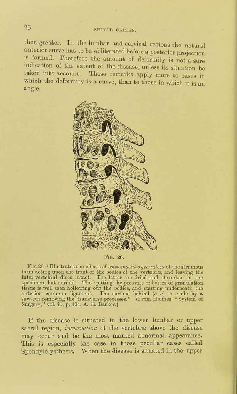 then greater. In the lumbar and cervical regions the natural anterior curve has to be obliterated before a posterior projection is formed. Therefore the amount of deformity is not a sure indication of the extent of the disease, unless its situation be taken into account. These remarks apply more to cases in which the deformity is a curve, than to those in which it is an angle. Fig. 26. Fig. 26  Illustrates the effects of osteo-myelitis graimlosa of the strumous form acting upon the front of the bodies of the vertebrae, and leaving the inter-vertebral discs intact. The latter are dried and shrunken in the specimen, but normal. The ' pitting' by pressure of bosses of granulation tissue is well seen hollowing out the bodies, and starting underneath the anterior common ligament. The surface behind {a a) is made by a saw-cut removing the transverse processes. (From Holmes'  System of Surgery, vol. ii., p. 404, A. E. Barker.) If the disease is situated in the lower lumbar or upper sacral region, incurvation of the vertebrae above the disease may occur and be the most marked abnormal appearance. This is especially the case in those peculiar cases called Spondylolysthesis. When the disease is situated in the upper