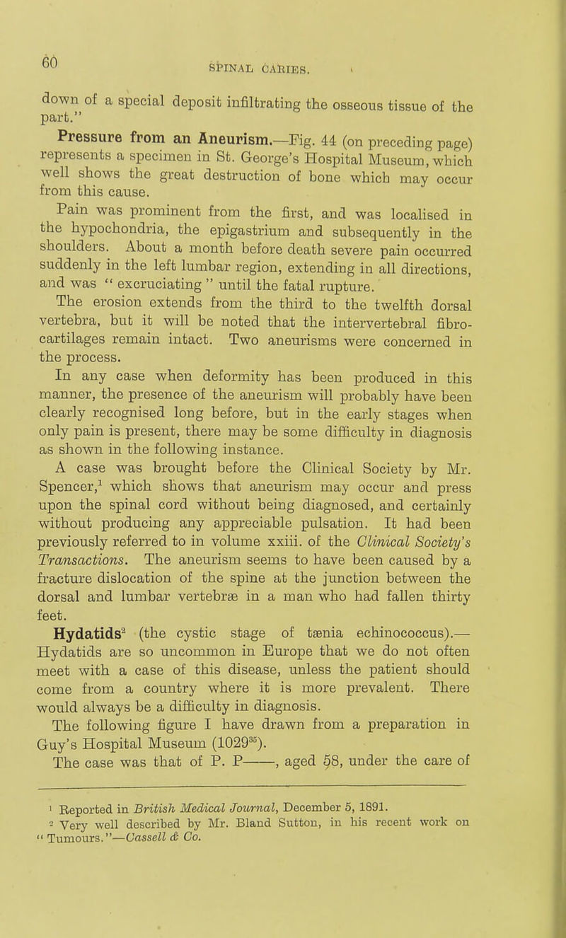 SPINAL GABIES. down of a special deposit infiltrating the osseous tissue of the part. Pressure from an Aneurism.—Fig. 44 (on preceding page) represents a specimen in St. George's Hospital Museum, which well shows the great destruction of bone which may occur from this cause. Pain was prominent from the first, and was locaUsed in the hypochondria, the epigastrium and subsequently in the shoulders. About a month before death severe pain occurred suddenly in the left lumbar region, extending in all directions, and was  excruciating  until the fatal rupture. The erosion extends from the third to the twelfth dorsal vertebra, but it will be noted that the intervertebral fibro- cartilages remain intact. Two aneurisms were concerned in the process. In any case when deformity has been produced in this manner, the presence of the aneurism will probably have been clearly recognised long before, but in the early stages when only pain is present, there may be some difficulty in diagnosis as shown in the following instance. A case was brought before the Clinical Society by Mr. Spencer,^ which shows that aneurism may occur and press upon the spinal cord without being diagnosed, and certainly without producing any appreciable pulsation. It had been previously referred to in volume xxiii. of the Clinical Society's Transactions. The aneurism seems to have been caused by a fracture dislocation of the spine at the junction between the dorsal and lumbar vertebrte in a man who had fallen thirty feet. Hydatids^ (the cystic stage of taenia echinococcus).— Hydatids are so uncommon in Europe that we do not often meet with a case of this disease, unless the patient should come from a country where it is more prevalent. There would always be a difiiculty in diagnosis. The following figure I have drawn from a preparation in Guy's Hospital Museum (1029^^). The case was that of P. P , aged 58, under the care of ' Reported in British Medical Jou/rnal, December 5, 1891. - Very well described by Mr. Bland Sutton, in his recent work on  Tumours.—Uassell & Co.