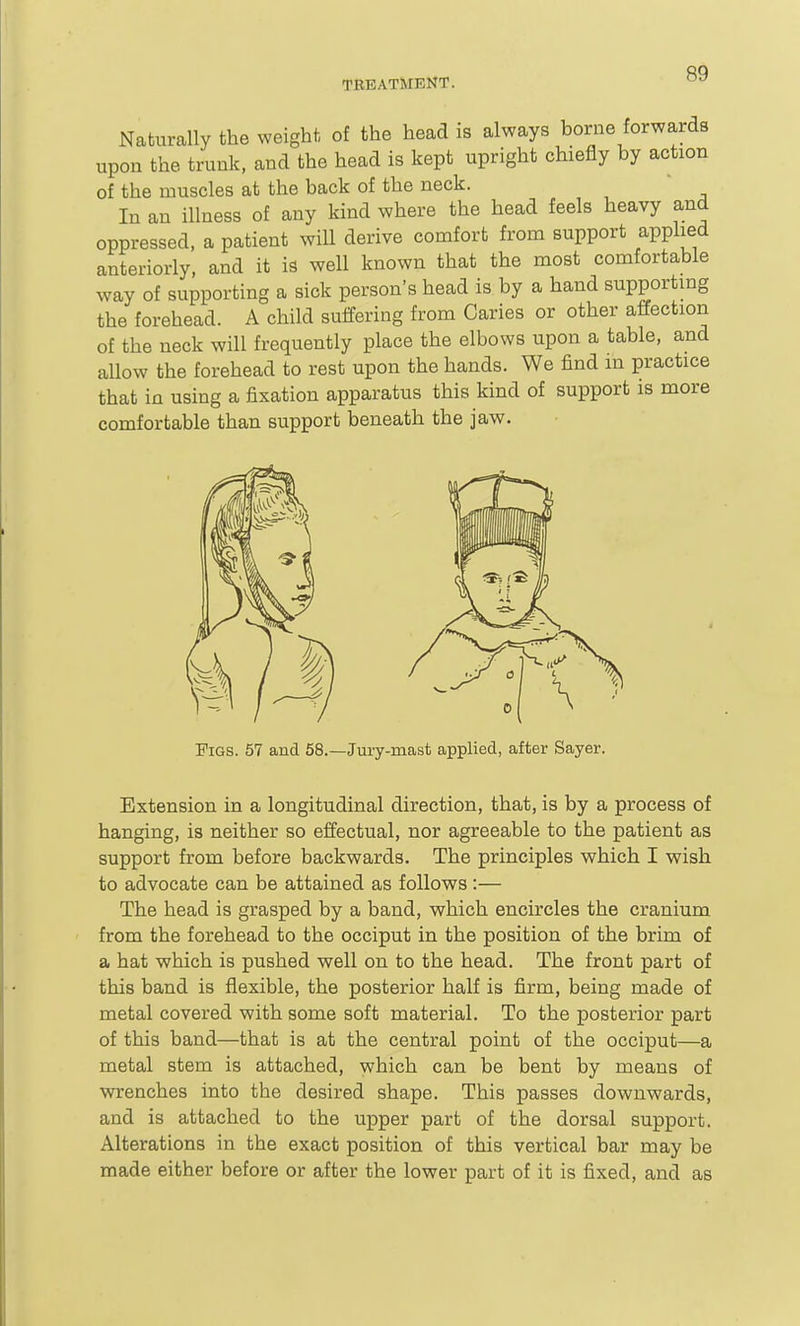 Naturally the weight of the head is always borne forwards upon the trunk, and the head is kept upright chiefly by action of the muscles at the back of the neck.  In an illness of any kind where the head feels heavy and oppressed, a patient will derive comfort from support applied anteriorly, and it is well known that the most comfortable way of supporting a sick person's head is by a hand supportmg the forehead. A child suffering from Caries or other affection of the neck will frequently place the elbows upon a table, and allow the forehead to rest upon the hands. We find m practice that in using a fixation apparatus this kind of support is more comfortable than support beneath the jaw. Figs. 57 and 58.—Jury-mast applied, after Sayer. Extension in a longitudinal direction, that, is by a process of hanging, is neither so effectual, nor agreeable to the patient as support from before backwards. The principles which I wish to advocate can be attained as follows :— The head is grasped by a band, which encircles the cranium from the forehead to the occiput in the position of the brim of a hat which is pushed well on to the head. The front part of this band is flexible, the posterior half is firm, being made of metal covered with some soft material. To the posterior part of this band—that is at the central point of the occiput—a metal stem is attached, which can be bent by means of wrenches into the desired shape. This passes downwards, and is attached to the upper part of the dorsal support. Alterations in the exact position of this vertical bar may be made either before or after the lower part of it is fixed, and as