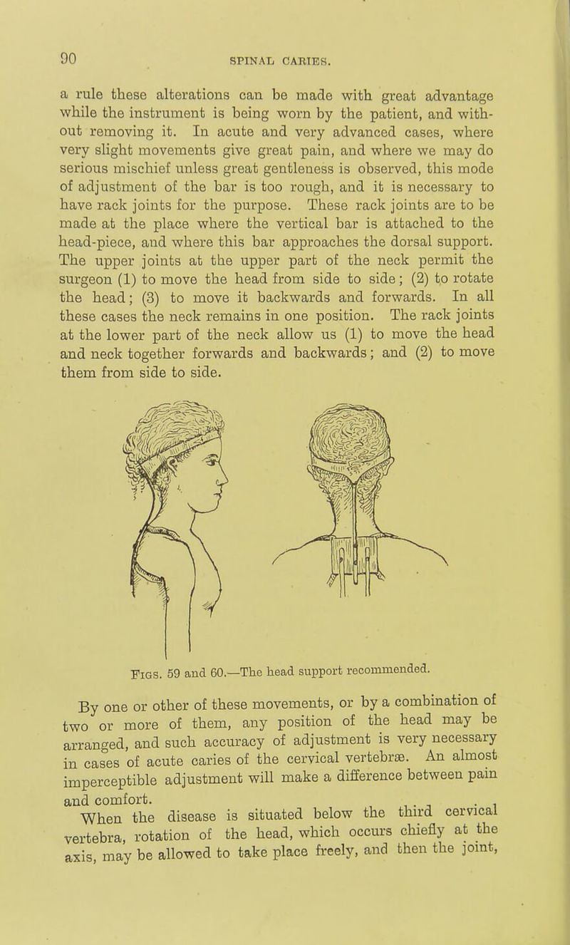 SPINAL CARIES. a rule these alterations can be made with great advantage while the instrument is being worn by the patient, and with- out removing it. In acute and very advanced cases, where very slight movements give great pain, and where we may do serious mischief unless great gentleness is observed, this mode of adjustment of the bar is too rough, and it is necessary to have rack joints for the purpose. These rack joints are to be made at the place where the vertical bar is attached to the head-piece, and where this bar approaches the dorsal support. The upper joints at the upper part of the neck permit the surgeon (1) to move the head from side to side; (2) to rotate the head; (3) to move it backwards and forwards. In all these cases the neck remains in one position. The rack joints at the lower part of the neck allow us (1) to move the head and neck together forwards and backwards; and (2) to move them from side to side. Figs. 59 and 60.—The head support recommended. By one or other of these movements, or by a combination of two or more of them, any position of the head may be arranged, and such accuracy of adjustment is very necessary in cases of acute caries of the cervical vertebrae. An almost imperceptible adjustment will make a difference between pam and comfort. When the disease is situated below the third cervical vertebra, rotation of the head, which occurs chiefly at the axis may be allowed to take place freely, and then the joint,