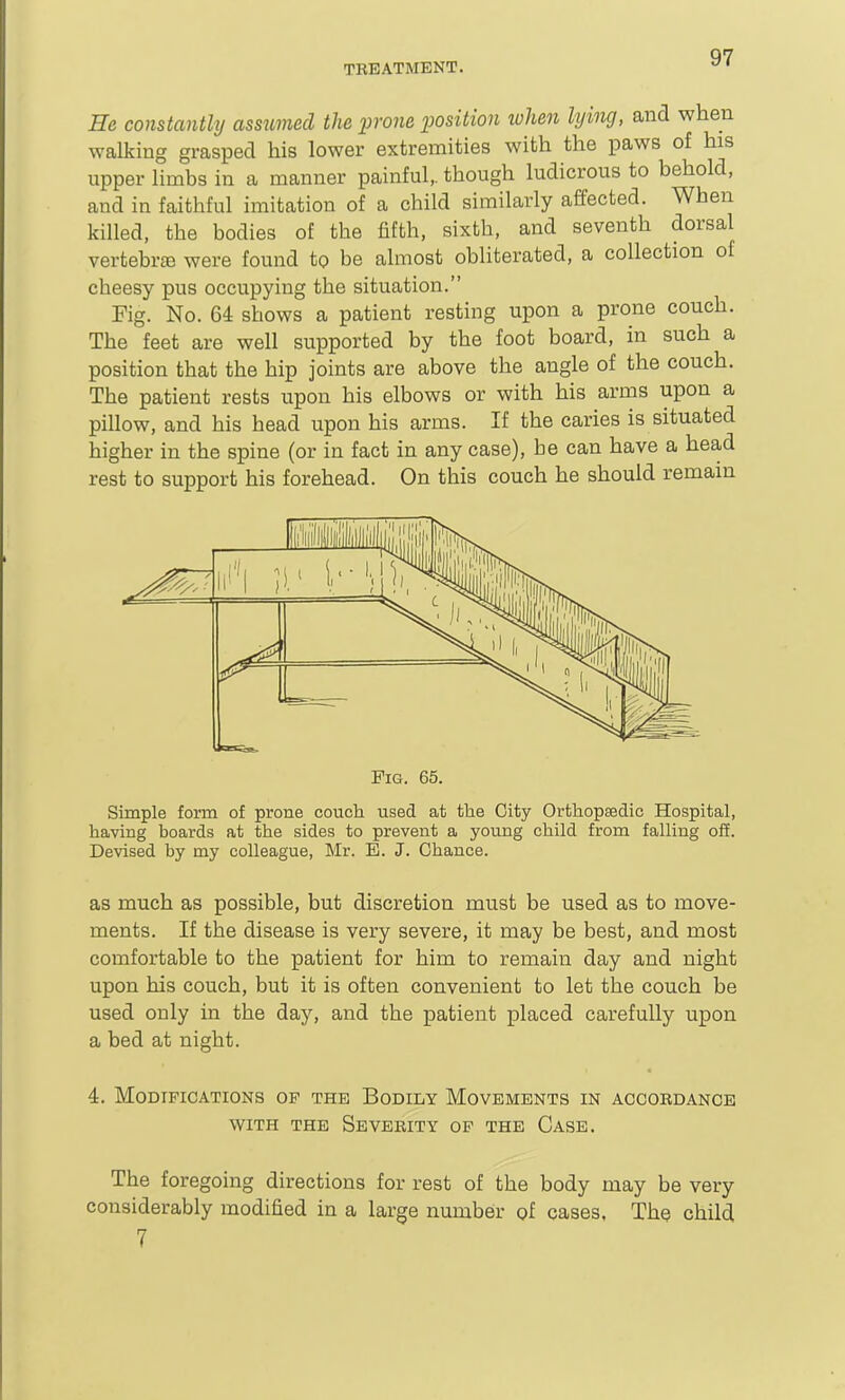 He constantly asstmiecl the -prone position token lying, and when walking grasped his lower extremities with the paws of his upper limbs in a manner painful,, though ludicrous to behold, and in faithful imitation of a child similarly affected. When killed, the bodies of the fifth, sixth, and seventh dorsal vertebrte were found to be almost obliterated, a collection of cheesy pus occupying the situation. Fig. No. 64 shows a patient resting upon a prone couch. The feet are well supported by the foot board, in such a position that the hip joints are above the angle of the couch. The patient rests upon his elbows or with his arms upon a pillow, and his head upon his arms. If the caries is situated higher in the spine (or in fact in any case), be can have a head rest to support his forehead. On this couch he should remain Pig. 65. Simple form of prone couch used at the City Orthopaedic Hospital, having hoards at the sides to prevent a young child from falling off. Devised by my colleague, Mr. E. J. Chance. as much as possible, but discretion must be used as to move- ments. If the disease is very severe, it may be best, and most comfortable to the patient for him to remain day and night upon his couch, but it is often convenient to let the couch be used only in the day, and the patient placed carefully upon a bed at night. 4. Modifications op the Bodily Movements in accordance WITH THE Severity op the Case. The foregoing directions for rest of the body may be very considerably modified in a large number of cases. The child 7