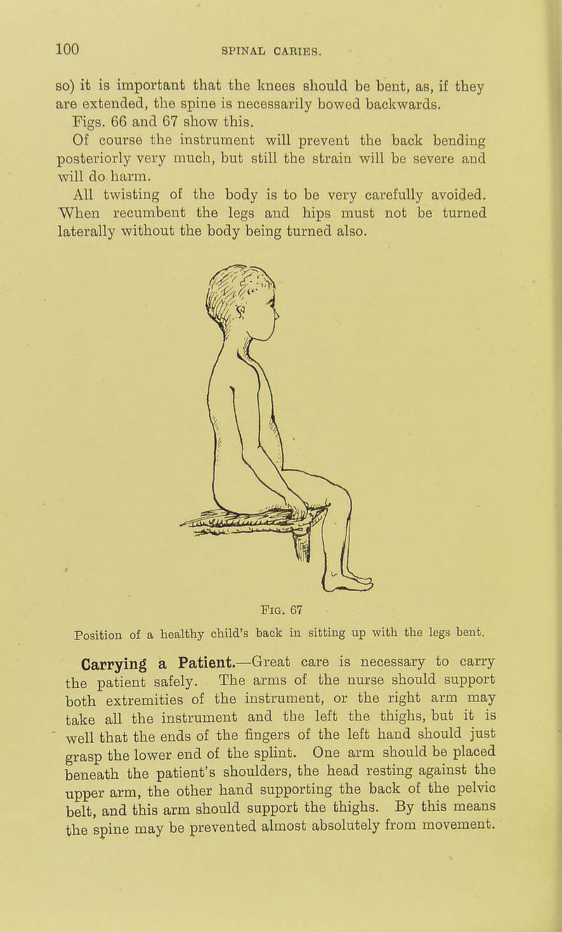 so) it is important that the knees should be bent, as, if they are extended, the spine is necessarily bowed backwards, Figs. 66 and 67 show this. Of course the instrument will prevent the back bending posteriorly very much, but still the strain will be severe and will do harm. All twisting of the body is to be very carefully avoided. When recumbent the legs and hips must not be turned laterally without the body being turned also. Fig. 67 Position of a healthy child's back in sitting up with the legs bent. Carrying a Patient.—Great care is necessary to carry the patient safely. The arms of the nurse should support both extremities of the instrument, or the right arm may take all the instrument and the left the thighs, but it is ' well that the ends of the fingers of the left hand should just grasp the lower end of the sphnt. One arm should be placed beneath the patient's shoulders, the head resting against the upper arm, the other hand supporting the back of the pelvic belt, and this arm should support the thighs. By this means the spine may be prevented almost absolutely from movement.