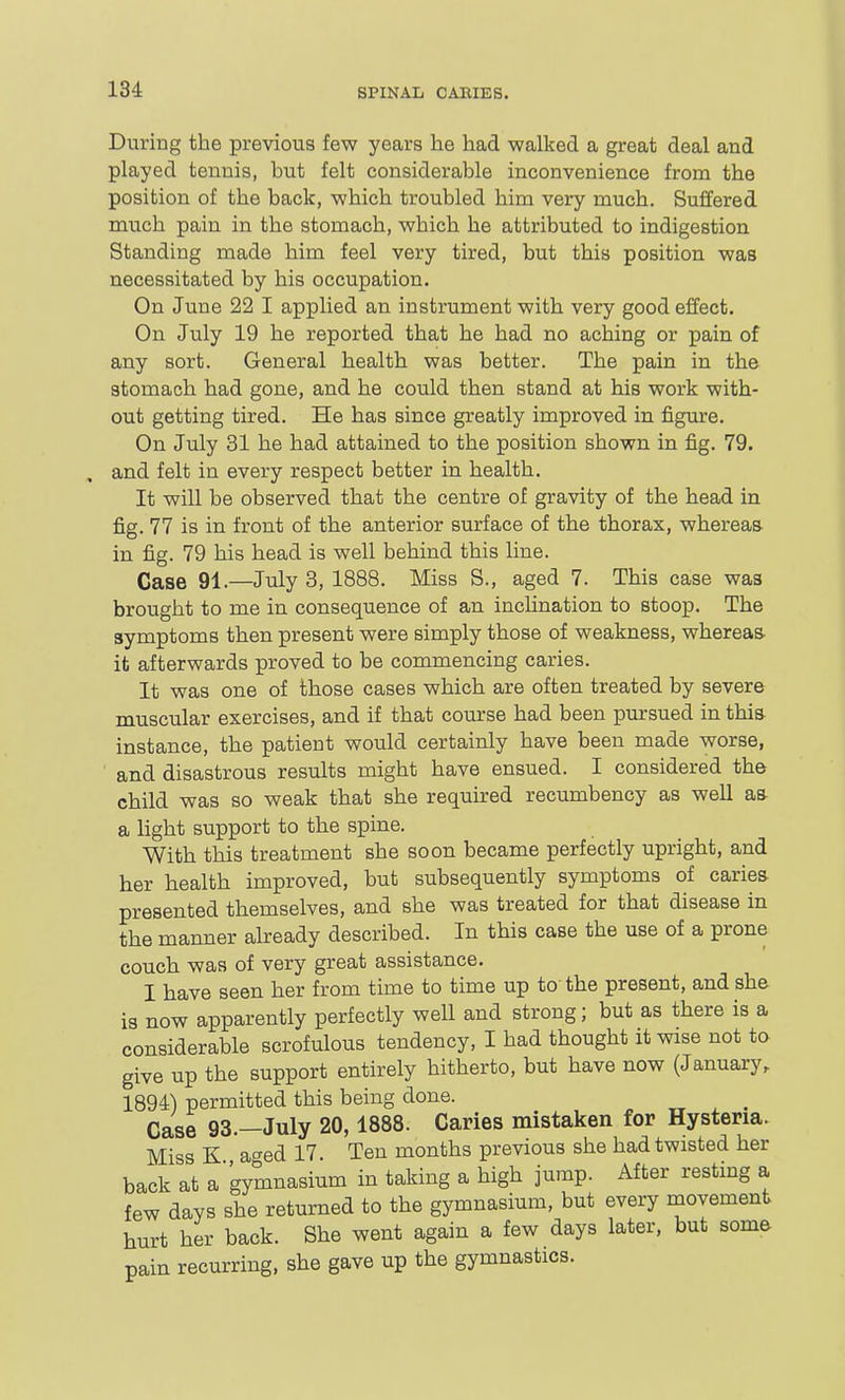 During the previous few years he had walked a great deal and played tenuis, but felt considerable inconvenience from the position of the back, which troubled him very much. Suffered much pain in the stomach, which he attributed to indigestion Standing made him feel very tired, but this position was necessitated by his occupation. On June 22 I applied an instrument with very good effect. On July 19 he reported that he had no aching or pain of any sort. General health was better. The pain in the stomach had gone, and he could then stand at his work with- out getting tired. He has since greatly improved in figure. On July 31 he had attained to the position shown in fig. 79. and felt in every respect better in health. It will be observed that the centre of gravity of the head in fig. 77 is in front of the anterior surface of the thorax, whereas in fig. 79 his head is well behind this line. Case 91.—July 3, 1888. Miss S., aged 7. This case was brought to me in consequence of an incUnation to stoop. The symptoms then present were simply those of weakness, whereas it afterwards proved to be commencing caries. It was one of those cases which are often treated by severe muscular exercises, and if that course had been pursued in this instance, the patient would certainly have been made worse, and disastrous results might have ensued. I considered the child was so weak that she required recumbency as well as a light support to the spine. With this treatment she soon became perfectly upright, and her health improved, but subsequently symptoms of caries presented themselves, and she was treated for that disease in the manner already described. In this case the use of a prone couch was of very great assistance. I have seen her from time to time up to the present, and she is now apparently perfectly well and strong; but as there is a considerable scrofulous tendency, I had thought it wise not to give up the support entirely hitherto, but have now (January, 1894) permitted this being done. ^ Case 93.—July 20,1888. Caries mistaken for Hysteria. Miss K ac^ed 17. Ten months previous she had twisted her back at agymnasium in taking a high jump. After resting a few days she returned to the gymnasium, but every movement hurt her back. She went again a few days later, but some pain recurring, she gave up the gymnastics.