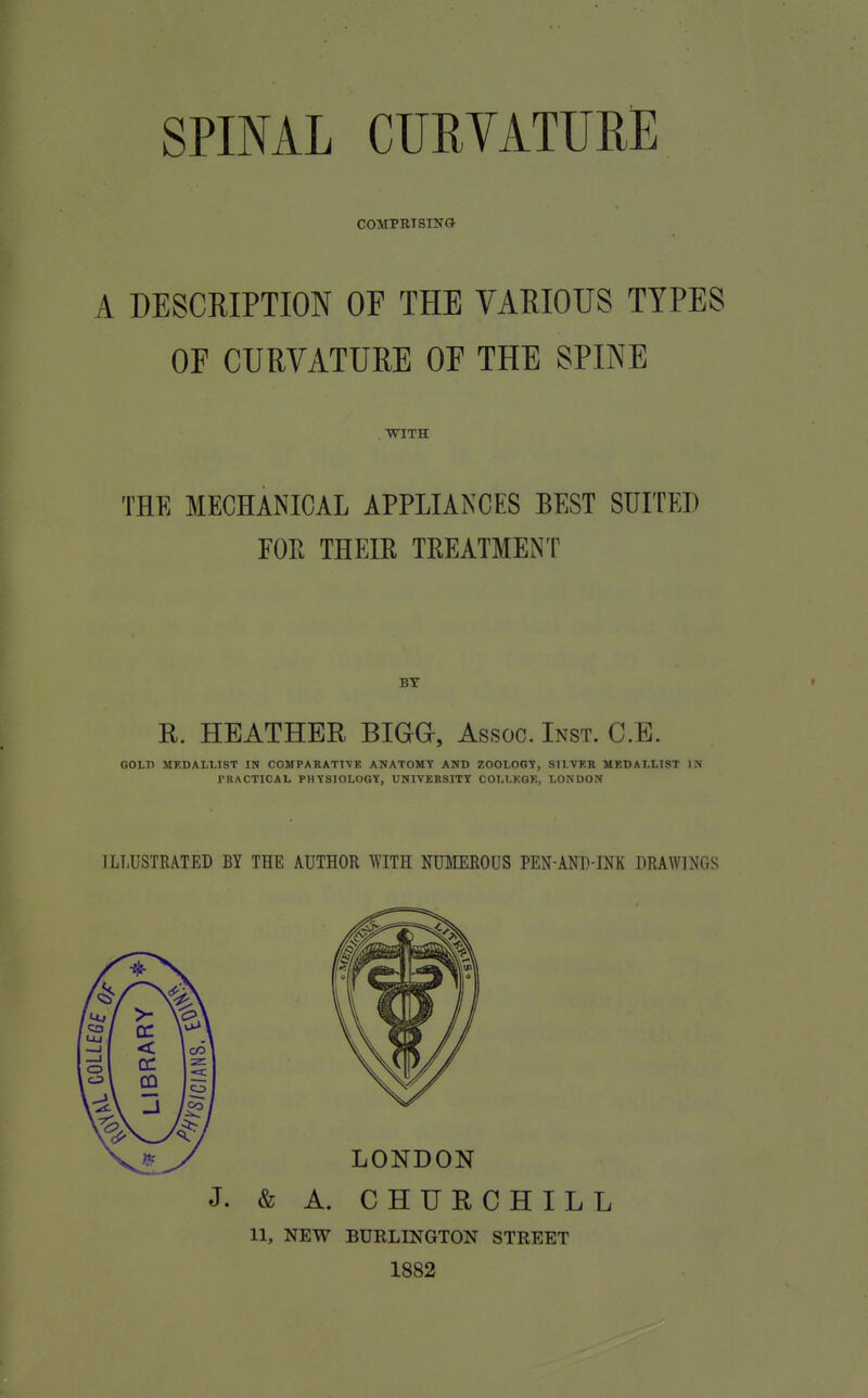 COMPRISING A DESCRIPTION OF THE VARIOUS TYPES OF CURVATURE OF THE SPINE . WITH THE MECHANICAL APPLIANCES BEST SUITED FOR THEIR TREATMENT BY R. HEATHER BIGG-, Assoc. Inst. C.E. GOLD MEDALLIST IN COMPARATIVE ANATOMY AND ZOOLOGY, SILVER MEDALLIST IN PRACTICAL PHYSIOLOGY, UNIVERSITY COLLEGE, LONDON ILLUSTRATED BY THE AUTHOR WITH NUMEROUS PEN-AND-INK DRAWINGS J. & A. CHURCHILL U, NEW BURLINGTON STREET 1882