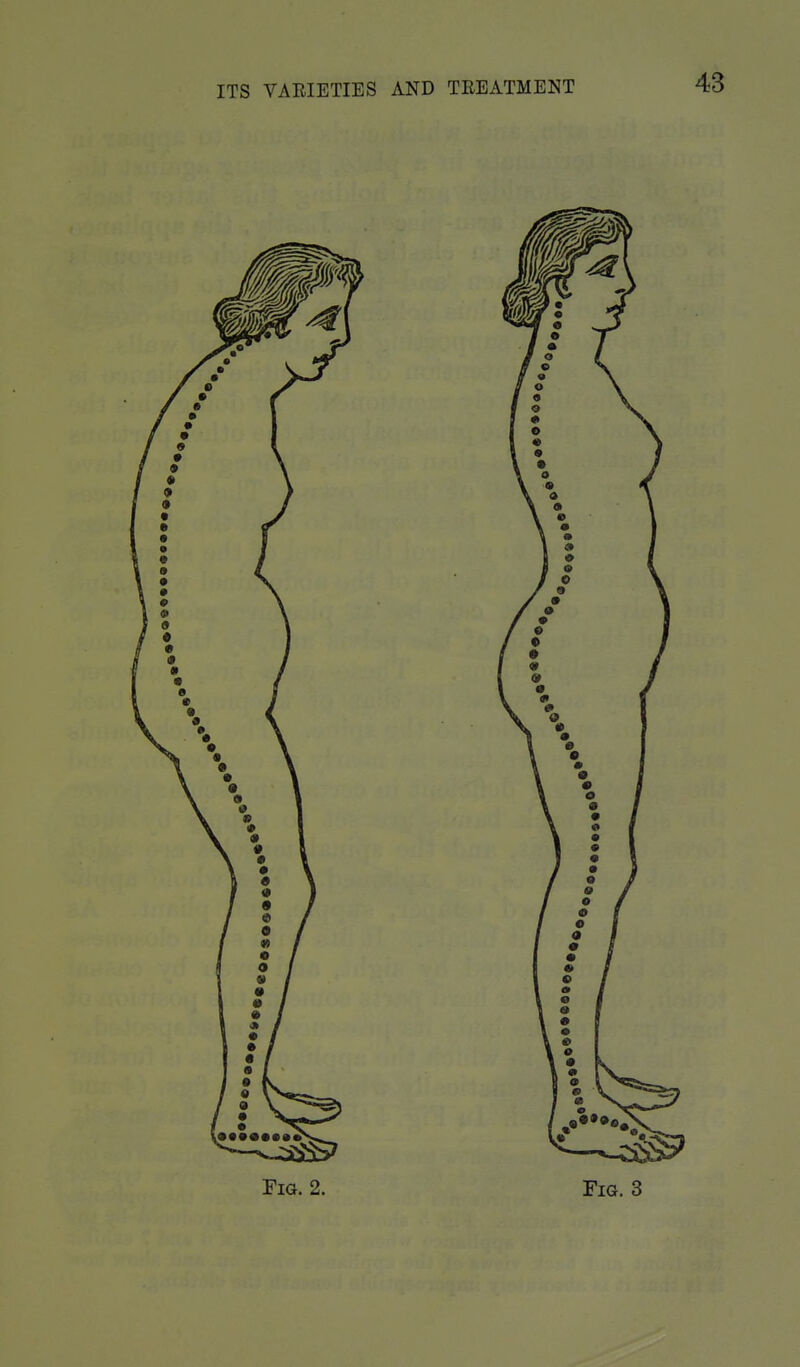 ITS VAEIETIES AND TREATMENT Fig. 2. Fig. 3