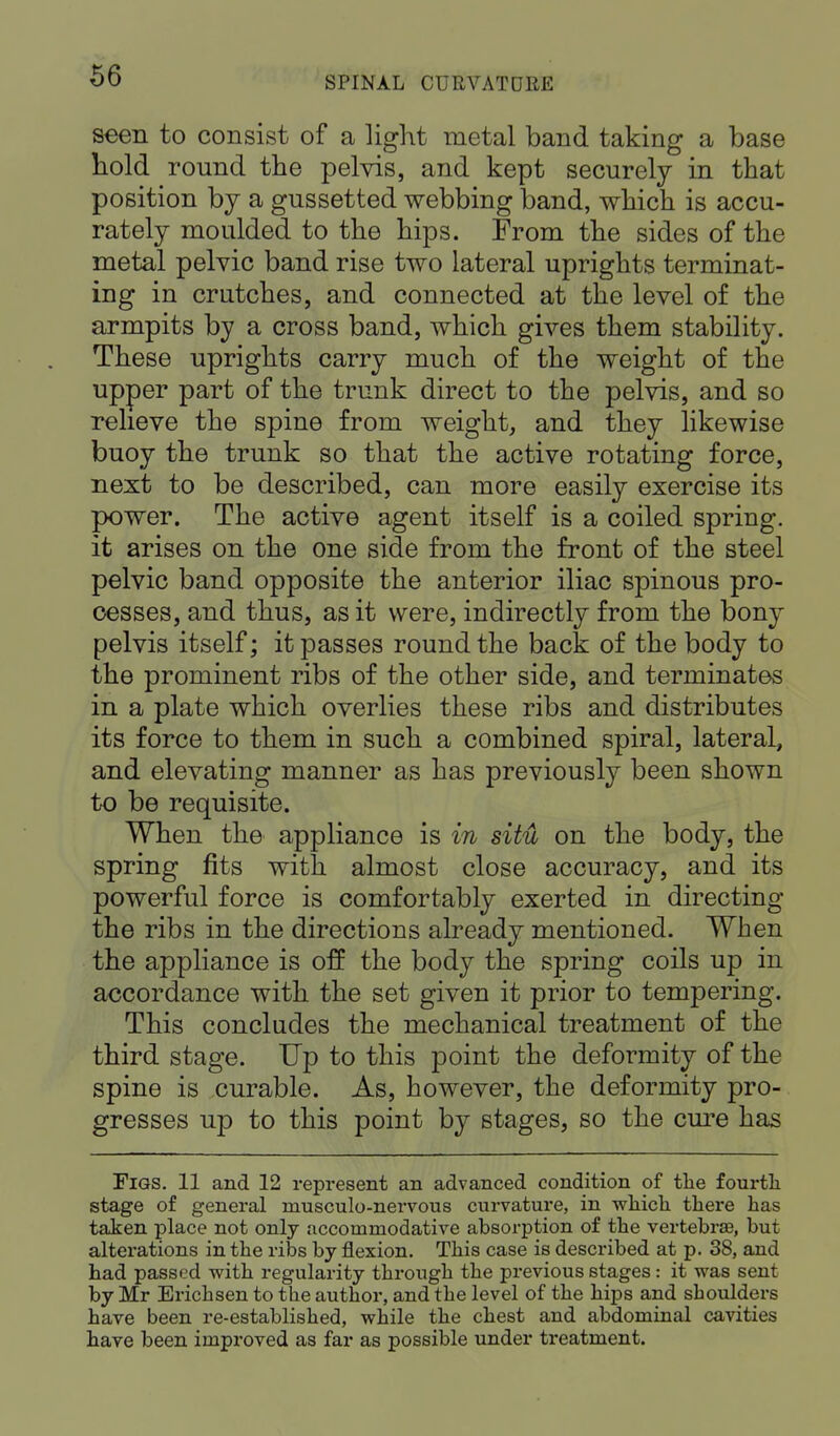 seen to consist of a light metal band taking a base bold round the pelvis, and kept securely in that position by a gussetted webbing band, which is accu- rately moulded to the hips. From the sides of the metal pelvic band rise two lateral uprights terminat- ing in crutches, and connected at the level of the armpits by a cross band, which gives them stability. These uprights carry much of the weight of the upper part of the trunk direct to the pelvis, and so relieve the spine from weight, and they likewise buoy the trunk so that the active rotating force, next to be described, can more easily exercise its power. The active agent itself is a coiled spring, it arises on the one side from the front of the steel pelvic band opposite the anterior iliac spinous pro- cesses, and thus, as it were, indirectly from the bony pelvis itself; it passes round the back of the body to the prominent ribs of the other side, and terminates in a plate which overlies these ribs and distributes its force to them in such a combined spiral, lateral, and elevating manner as has previously been shown to be requisite. When the appliance is in situ on the body, the spring fits with almost close accuracy, and its powerful force is comfortably exerted in directing the ribs in the directions already mentioned. When the appliance is off the body the spring coils up in accordance with the set given it prior to tempering. This concludes the mechanical treatment of the third stage. Up to this point the deformity of the spine is curable. As, however, the deformity pro- gresses up to this point by stages, so the cure has Tigs. 11 and 12 represent an advanced condition of the fourth stage of general rnusculo-nervous curvature, in which thex*e has taken place not only accommodative absorption of the vertebras, but alterations in the ribs by flexion. This case is described at p. 38, and had passed with regularity through the previous stages : it was sent by Mr Ericbsen to tbe author, and tbe level of the hips and shoulders have been re-established, while the chest and abdominal cavities have been improved as far as possible under treatment.