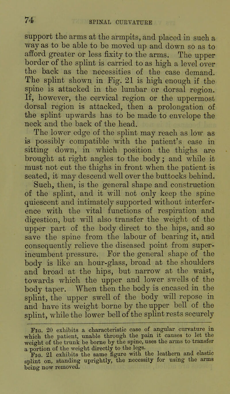 support the arms at the armpits, and placed in such a way as to be able to be moved up and down so as to afford greater or less fixity to the arms. The upper border of the splint is carried to as high a level over the back as the necessities of the case demand. The splint shown in Fig. 21 is high enough if the spine is attacked in the lumbar or dorsal region. If, however, the cervical region or the uppermost dorsal region is attacked, then a prolongation of the splint upwards has to be made to envelope the neck and the back of the head. The lower edge of the splint may reach as low as is possibly compatible with the patient's ease in sitting down, in which position the thighs are brought at right angles to the body; and while it must not cut the thighs in front when the patient is seated, it may descend well over the buttocks behind. Such, then, is the general shape and construction of the splint, and it will not only keep the spine quiescent and intimately supported without interfer- ence with the vital functions of respiration and digestion, but will also transfer the weight of the upper part of the body direct to the hips, and so save the spine from the labour of bearing it, and consequently relieve the diseased point from super- incumbent pressure. For the general sha]3e of the body is like an hour-glass, broad at the shoulders and broad at the hips, but narrow at the waist, towards which the upper and lower swells of the body taper. When then the body is encased in the splint, the upper swell of the body will repose in and have its weight borne by the upper bell of the splint, while the lower bell of the splint rests securely Fig. 20 exhibits a characteristic case of angular curvature in which the patient, unable through the pain it causes to let the weight of the trunk be borne by the spine, uses the arms to transfer a portion of the weight directly to the legs. Fig. 21 exhibits the same figure with the leathern and elastic splint'on, standing uprightly, the necessity for using the arms being now removed.