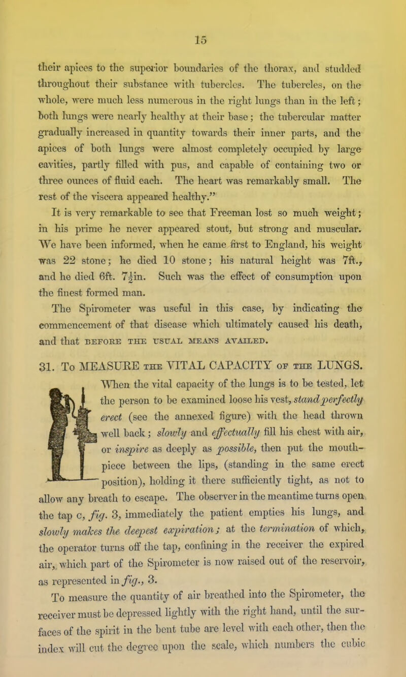 their apices to the supei-ior boundaries of the thorax, and studded tlu'oughout their substance with tubercles. The tubei-cles, on tlie whole, were much less numerous in the right lungs than in the left; both hmgs were nearly healthy at their base; the tubercular matter gradually increased in quantity towards their inner parts, and the apices of both lungs were almost completely occupied by large cavities, partly filled with pus, and capable of containing two or three oxmces of fluid each. The heart was remarkably small. The rest of the viscera appealed healthy. It is very remarkable to see that Freeman lost so much weight; in his prime he never appeared stout, but strong and muscular. We have been informed, when he came first to England, his weight was 22 stone; he died 10 stone; his natural height was 7ft., and he died 6ft. 7^in. Such was the effect of consumption upon the finest formed man. The Spirometer was useful in this case, by indicating the commencement of that disease which ultimately caused his death, and that befoee the rsuAx. means availed. 31. To MEASUKE the VITAL CAPACITY of the LUNGS. ft^\^len the vital capacity of the lungs is to be tested, let the person to be examined loose his vest, stand perfectly erect (sec the annexed figure) with the head thrown well back; slowly and effectually fill his chest with air, or inspire as deeply as possible, then put the mouth- piece between the lips, (standing in the same erect ■ position), holding it there sufficiently tight, as not to allow any breath to escape. The observer in the meantime tm-ns open the tap c, f ig. 3, immediately the patient empties his lungs, and slowly makes the deepest expiration; at the termination of which, the operator tm-ns off the tap, confining in the receiver the expired air,, which part of the Spirometer is now raised out of the reservoir, as represented in fig., 3. To measure the quantity of air breathed into the Spirometer, the receiver must be depressed lightly with the right hand, until the sur- faces of the spirit in the bent tube are level with each other, then the index will cut the degree upon the scale, which numbers the cubic