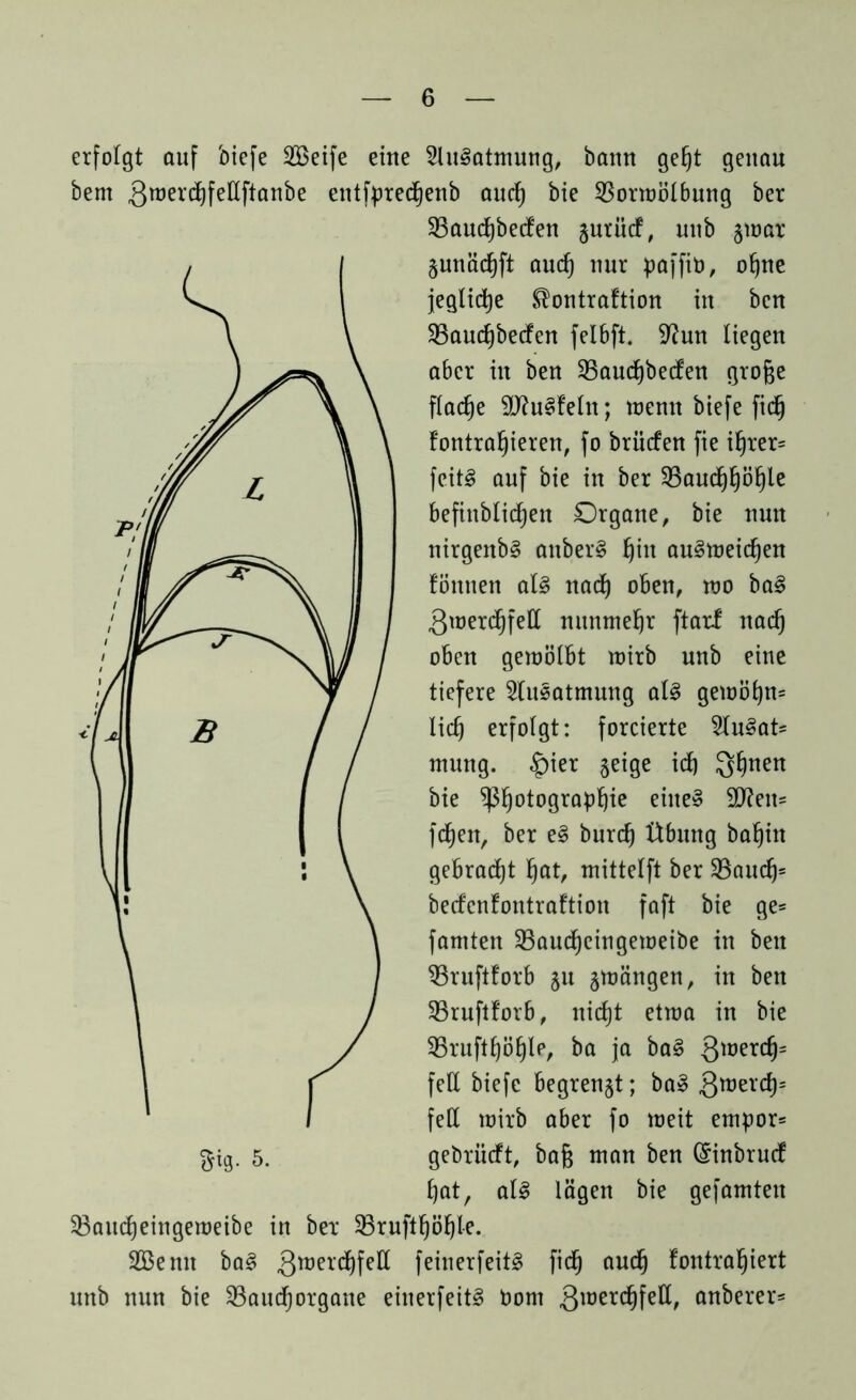 erfolgt auf btefe Seife eine 5lu§atmung, bann geht genau öem 3roerdhfeüftanbe entfpredfjenb auch bie 23orwölbung ber 33audE)be(fen jurüct, uub §war gunächft auch nur paffit), ohne jegliche ®ontraftion in bcn 23aucf)be<fen felbft. 9?un liegen aber in ben 23aucf)becfett große flache ttftuetteln; wenn biefe fid) fontrahieren, fo brürfen fie ihrer* feit£ auf bie in ber 23aucf)f)öf)le befinblidjeu Organe, bie nun nirgenb§ anber§ ^iit au§weid)en tonnen al§ nad) oben, wo ba§ 3werd)fett nunmehr ftarf nad) oben gewölbt wirb unb eine tiefere Ausatmung al§ gewöhn* ließ erfolgt: forcierte 2lu3at* mung. |)ier ^eige icf) Qtjnen bie ^Photographie eiltet 9tteit* fchen, ber e§ burch Übung bahin gebracht hat, mittelft ber $Baud)= berfenfontraftion faft bie ge* famten SBaudheingeweibe in ben ^Bruftforb ju jwängen, in ben SBruftforb, nicht etwa in bie ^Brufthöhle, ba ja ba§ Qwerch= fett biefe begrenzt; ba» Qrüzxty fett wirb aber fo weit empor* gebrüeft, baß man ben (Sinbrudt hat, aU lägen bie gefamtett ^Baudheingeweibe in ber SBrufthöhl-e. Senn ba§ 3tt,et'chfett feinerfeit§ fid) auch fontrahiert unb nun bie SBaudf)organe einerfeit§ bom 3lüerchfett, anberer*