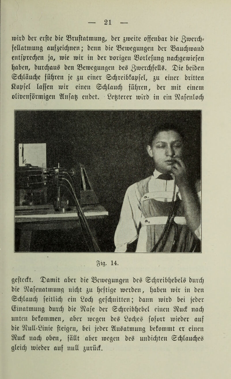 nrirb ber erfte bie Bruftntmung, ber jweite offenbar bie gwerdj* fellatmuug auf^eidjuen; beim bie Bewegungen ber Bandjwaub entfpredjen ja, wie wir in ber Oorigen Borlefung nadjgewiefeit fjaben, bnrd)au3 ben Bewegungen be3 3lüerc^feß^- beibeit ©cf)Iäud)e fiteren je §n einer ©djreibfapfel, 5« einer britten Zapfet laffett wir einen ©djlaud) führen, ber mit einem otioenförmigen 21nfa| enbet. Öejterer wirb in ein üftafeitlodj m 14. geftccft. £)amit aber bie Bewegungen bc§ 0djreibljebel3 burdj bie Sftafeuatmung nidjt 511 fjeftige werben, Traben wir in ben ©djlaud) feitlidj ein £od) gefdjnittcn; bann wirb bei jeber (Einatmung burd) bie 9?afe ber (Sdjreibfyebet einen 9?ud nad) unten befommeit, aber wegen be3 2odje§ fofort wieber auf bie 9cu(t=£inie fleigeti, bei jeber ^Iwsatmung befommt er einen 9?ud nad) oben, faßt aber wegen be§ nubidjtcn (Scbtaudje^ gleid) wieber auf und jurüd.