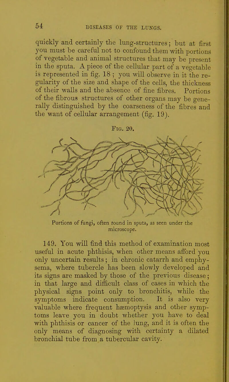 quickly and certainly the lung-structures; but at first you must be careful not to confound tlieni with portions of vegetable and animal structures that may be present in the sputa. Apiece of the cellular part of a vegetable is represented in fig. 18 ; you will observe in it the re- gularity of the size and shape of the cells, the thickness of their walls and the absence of fine fibres. Portions of the fibrous structures of other organs may be gene- rally distinguished by the coarseness of the fibres and the want of cellular arrangement (fig. 19). Fig. 20. Portions of fungi, often found in sputa, as seen under the microscope. 149. You will find this method of examination most useful in acute phthisis, when other means afford you only uncertain results; in chronic catarrh and emphy- sema, where tubercle has been slowly developed and its signs are masked by those of the previous disease; in that large and difficult class of cases in which the physical signs point only to bronchitis, while the symptoms indicate consumption. It is also very valuable where frequent haemoptysis and other symp- toms leave you in doubt whether you have to deal with phthisis or cancer of the lung, and it is often the only means of diagnosing with certainty a dilated bronchial tube from a tubercular cavity.