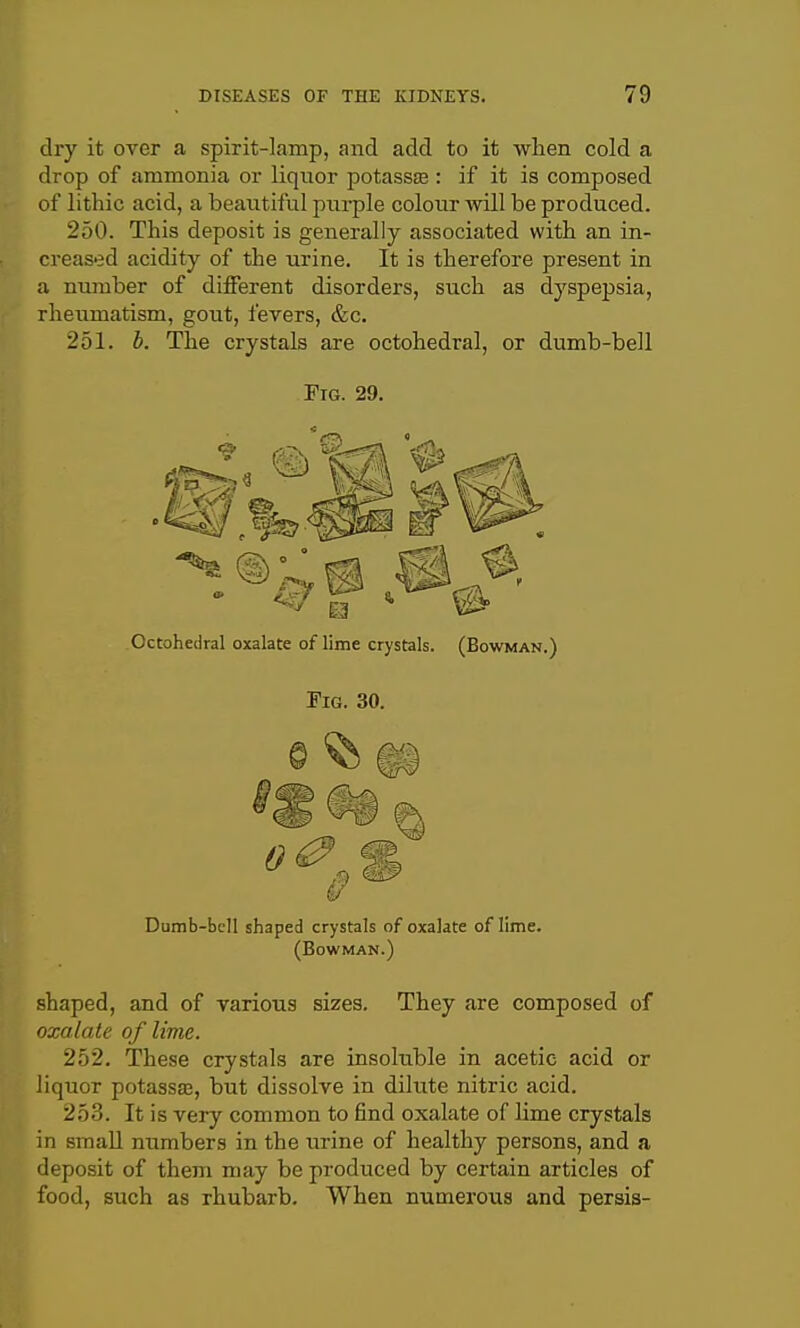 dry it over a spirit-lamp, and add to it when cold a drop of ammonia or liquor potassiE : if it is composed of lithic acid, a beautiful purple colour will be produced. 250. This deposit is generally associated with an in- creased acidity of the urine. It is therefore present in a number of different disorders, such as dyspepsia, rheumatism, gout, fevers, &c. 251. b. The crystals are octohedral, or dumb-bell Fig. 29. Durab-bcll shaped crystals of oxalate of lime. (Bowman.) shaped, and of various sizes. They are composed of oxalate of lime. 252. These crystals are insoluble in acetic acid or liquor potassas, but dissolve in dilute nitric acid. 253. It is very common to find oxalate of lime crystals in small numbers in the urine of healthy persons, and a deposit of them may be produced by certain articles of food, such as rhubarb. When numerous and persis-